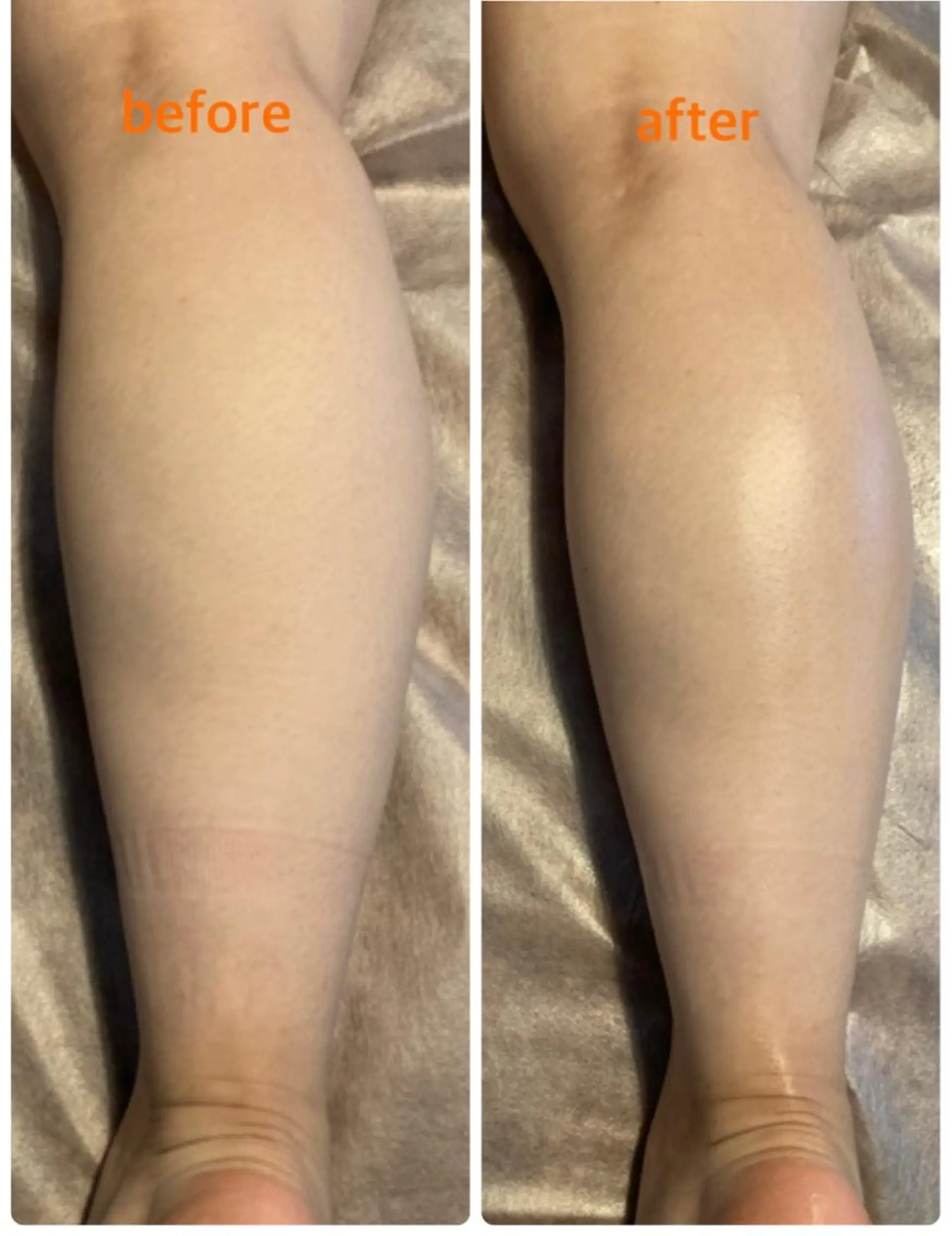 bellissimo 【ベリッシモ】所属・ちひろ　痩身/ハーブ bellissimoのエステ・リラクイメージ