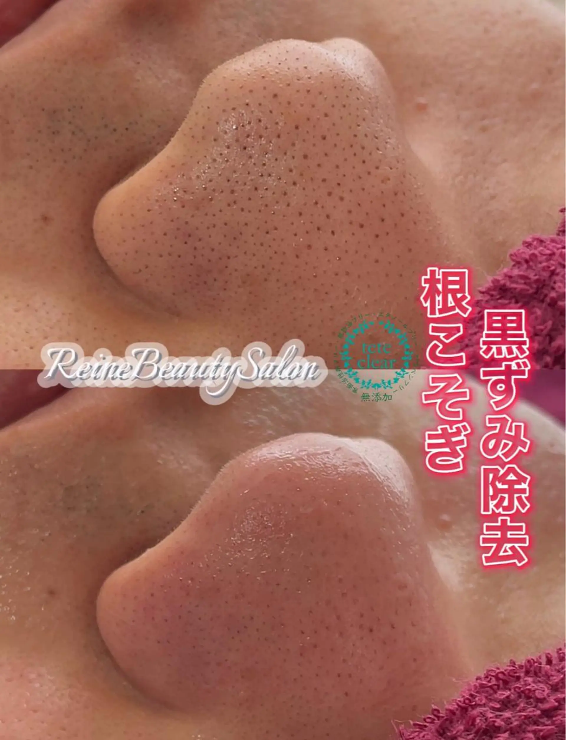 Reine BeautySalon所属・毛穴/シミ肝斑/脱毛 横山梨里のエステ・リラクイメージ