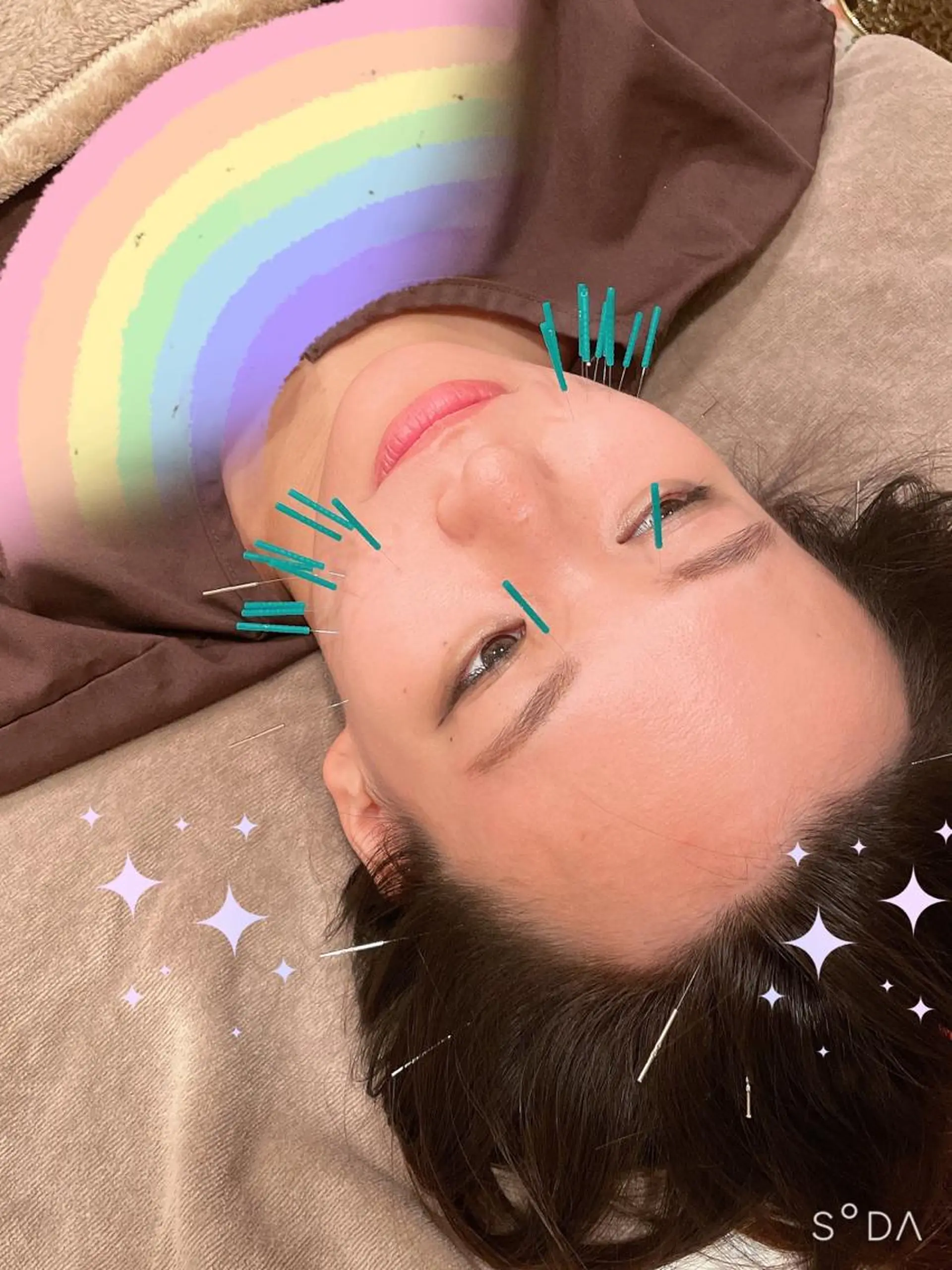 エステ リラク 美容鍼灸サロン      APLUS所属・美容鍼灸サロン APLUSのエステ・リラクイメージ