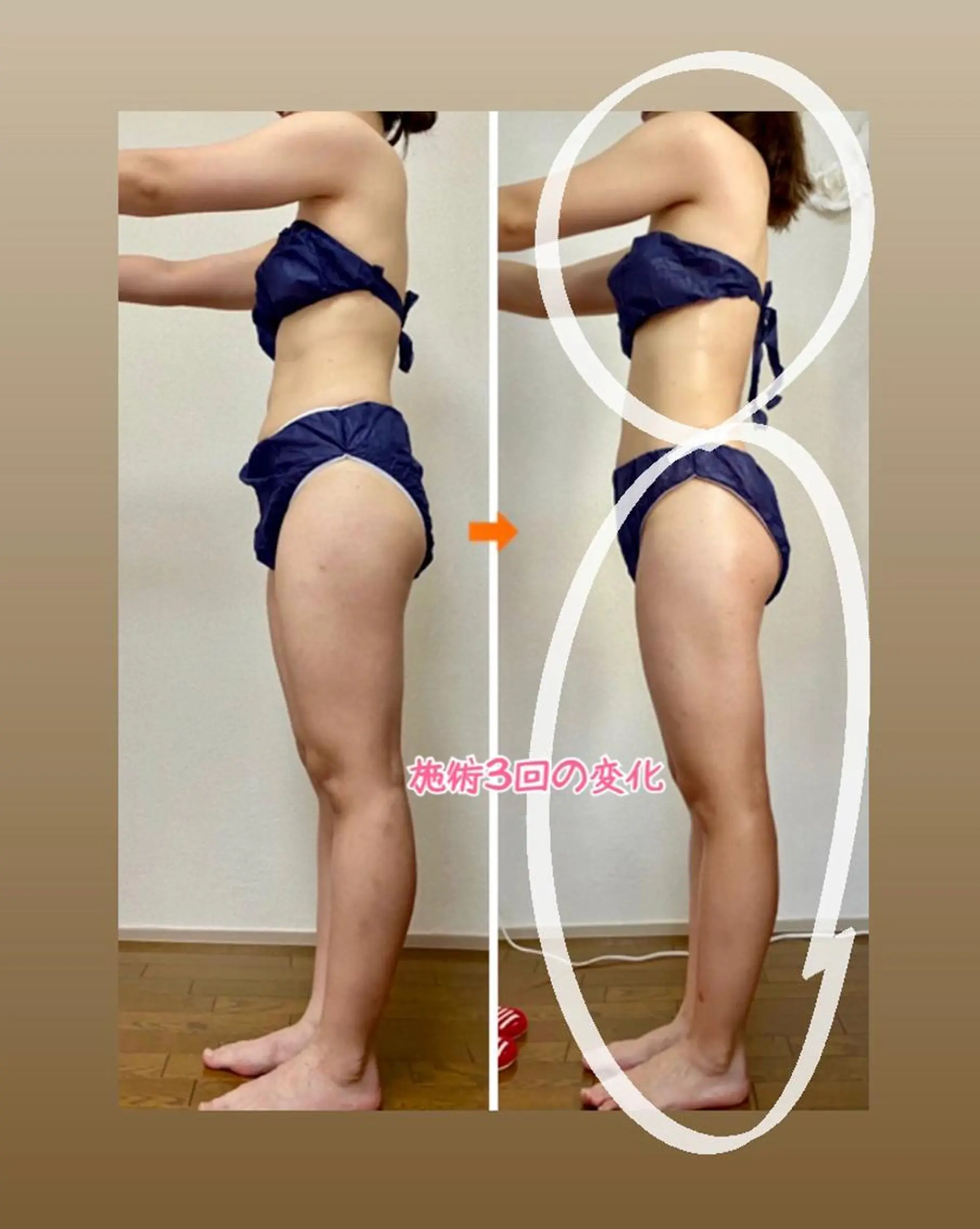 ショート カラー パーマ ヘアアレンジ メンズ キッズ ネイル マツエク・マツパ マットネイル 赤色 痩身&ボディ 結果出し🌟丹野のエステ・リラクイメージ