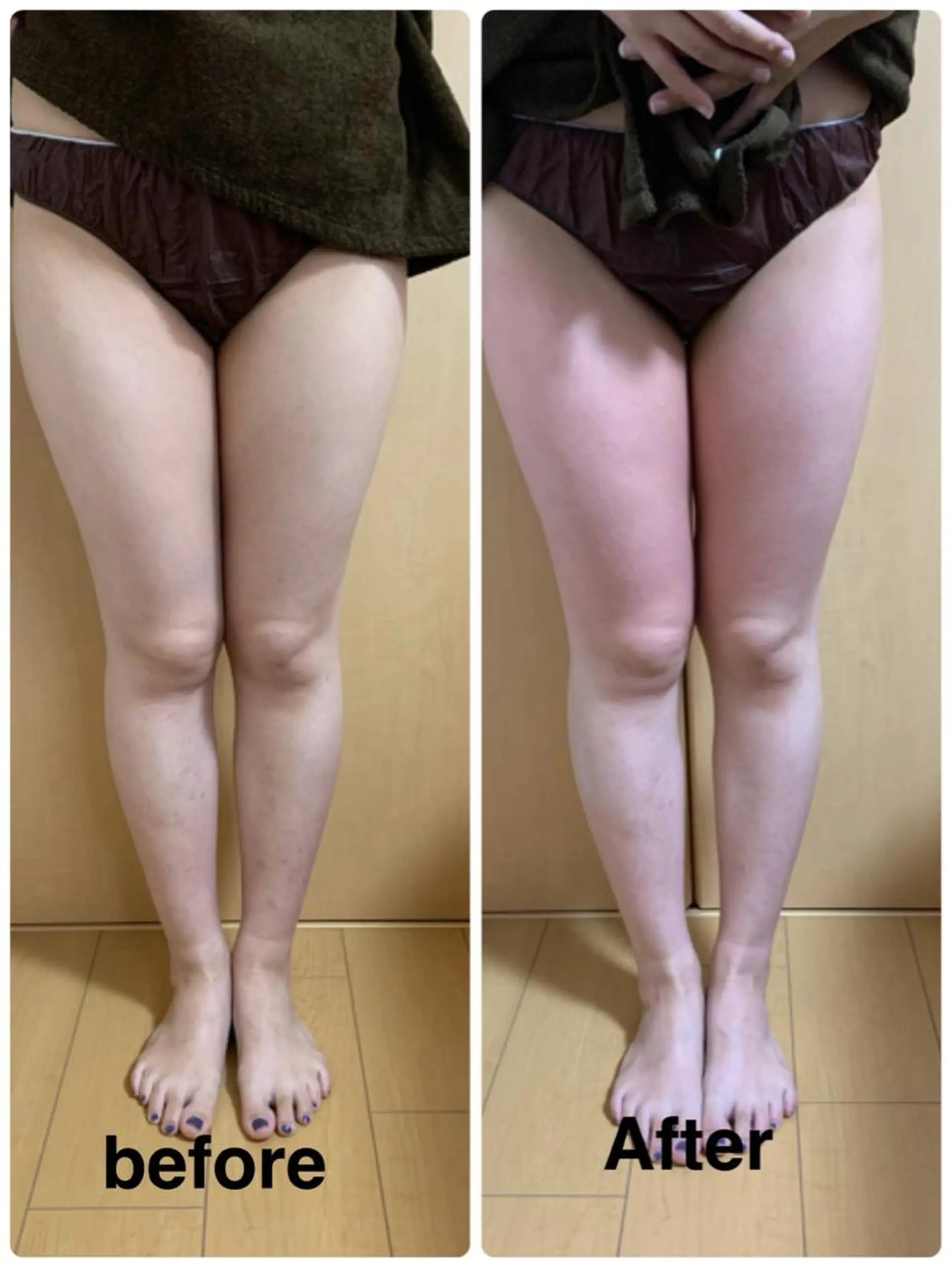 エステ リラク 痩身/脱毛/ネイル HARUKAのエステ・リラクイメージ