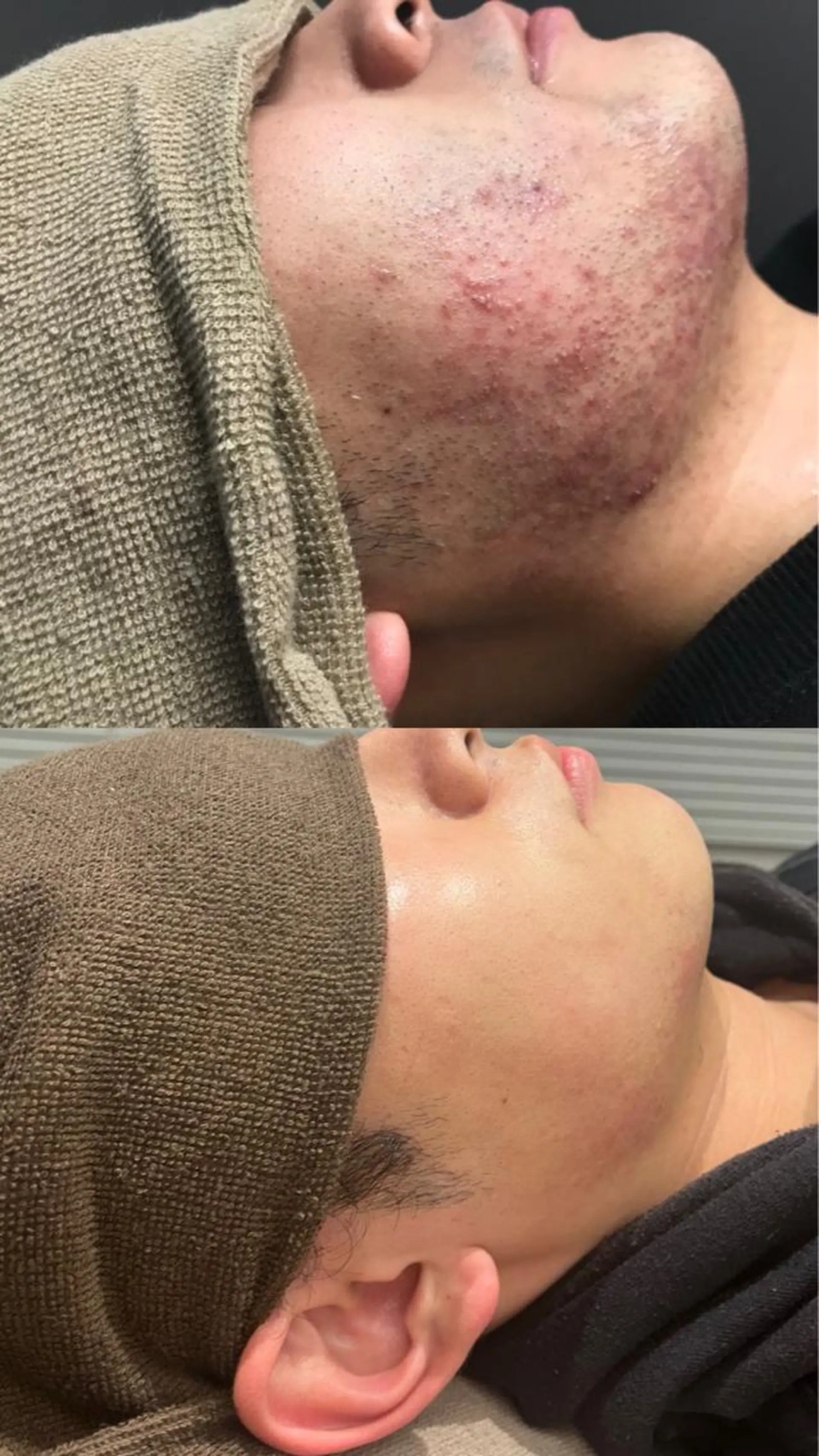 脱毛 Lilyboo 池袋のエステ・リラクイメージ