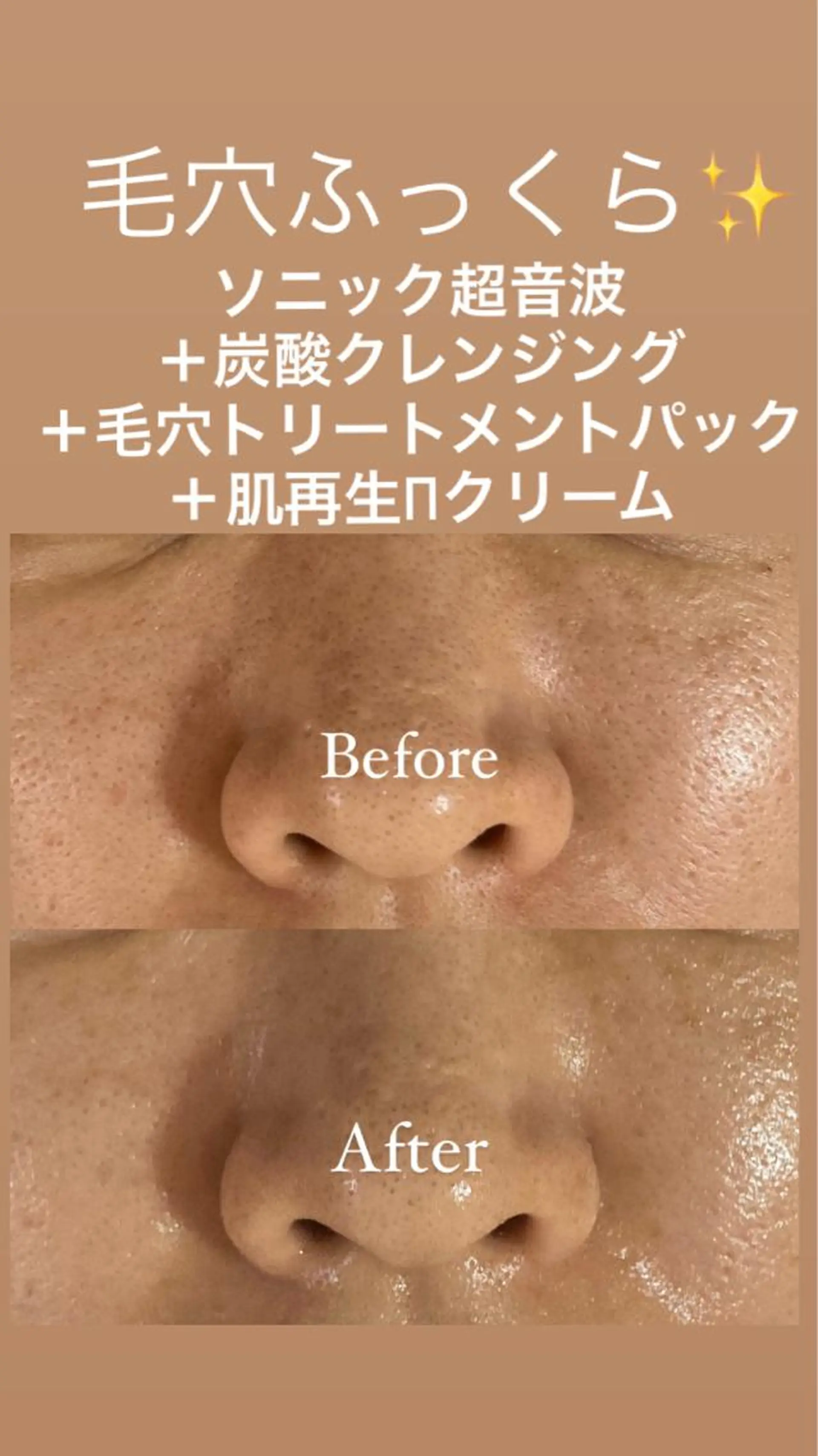 eyelash・aesthetic salon KANARU所属・KANARU ♡真七海♡のマツエク・マツパデザイン