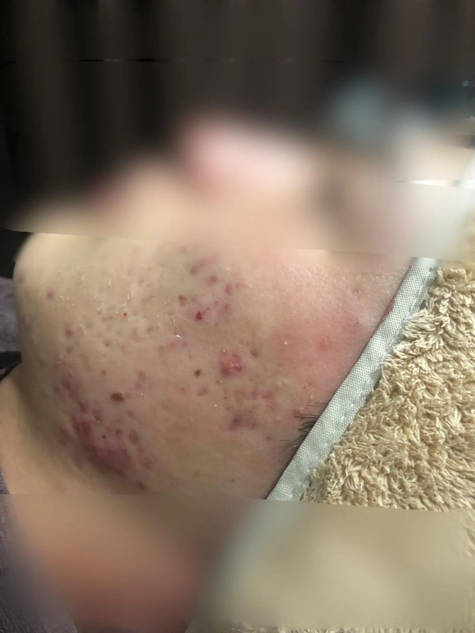 エステ リラク セントラル鍼灸院 Re:laxyのエステ・リラクイメージ