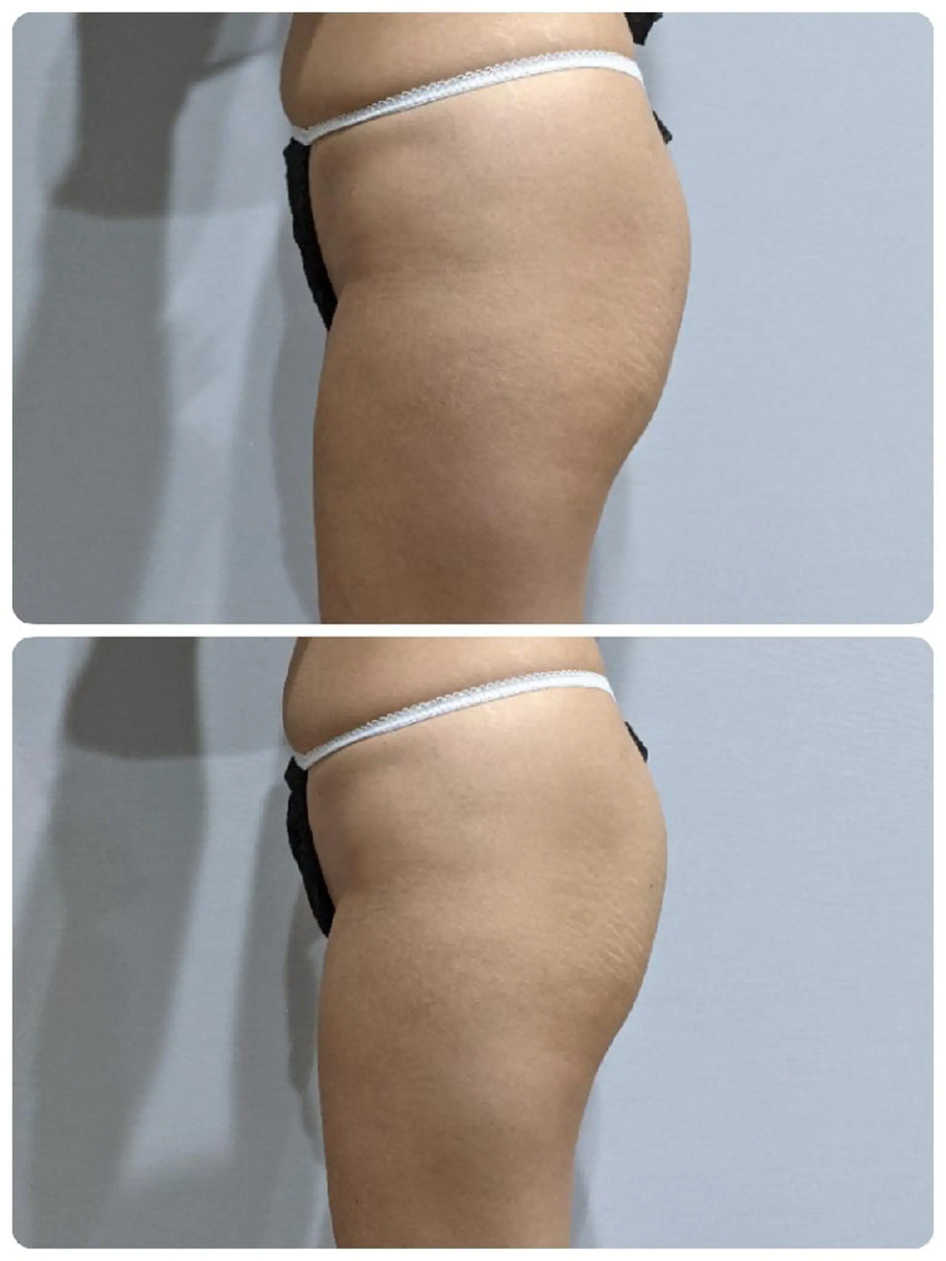 TRILOGY 安田美子のエステ・リラクイメージ