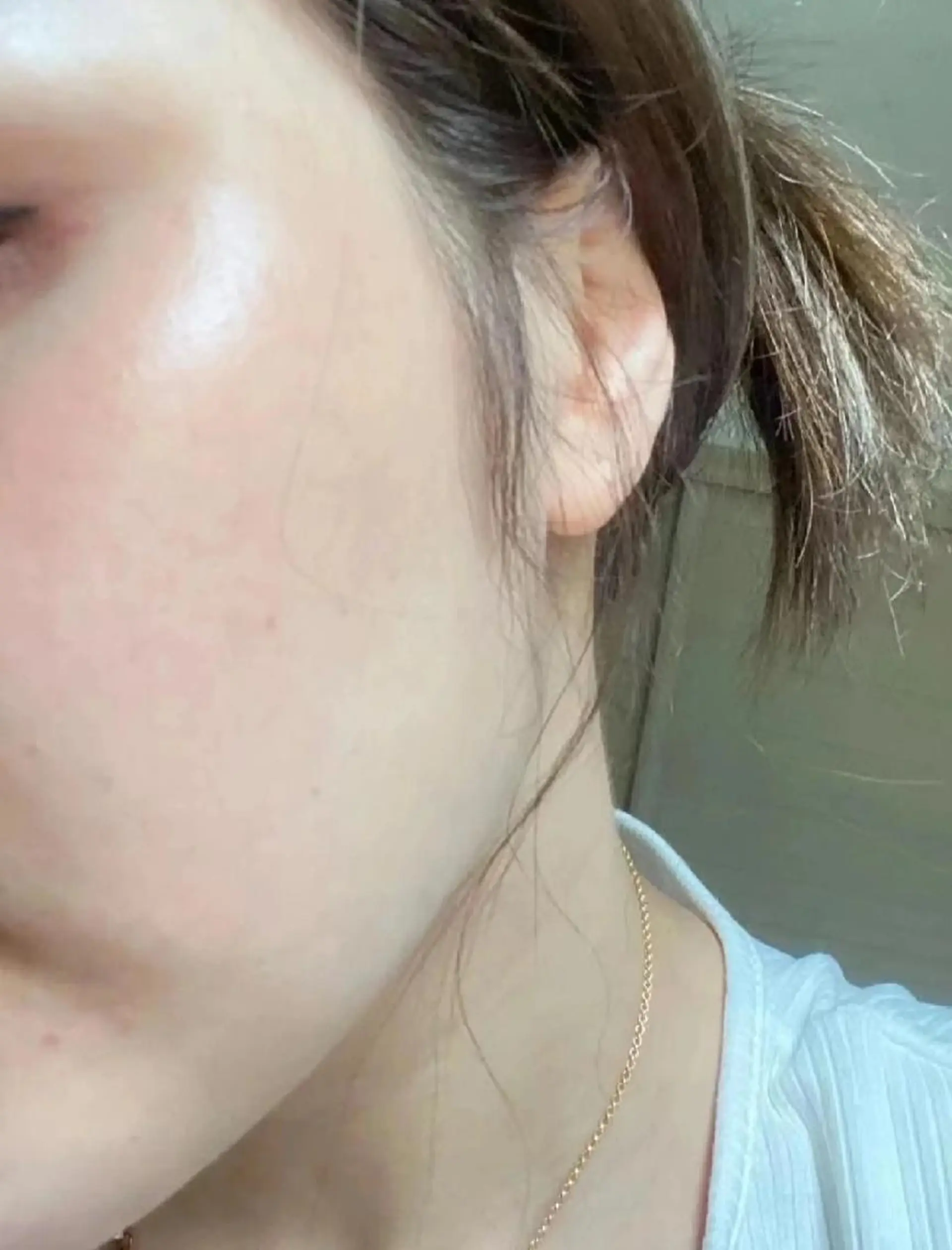 脱毛 aliaハイフ&水光ジェットサロン所属・aliaハーブ水光店 エステティシャン募集のエステ・リラクイメージ