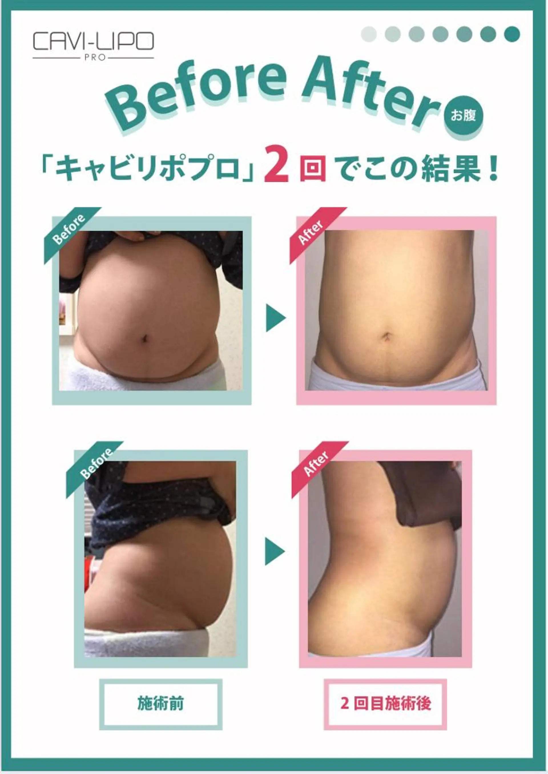 エステ エステサロン JURISのエステ・リラクイメージ