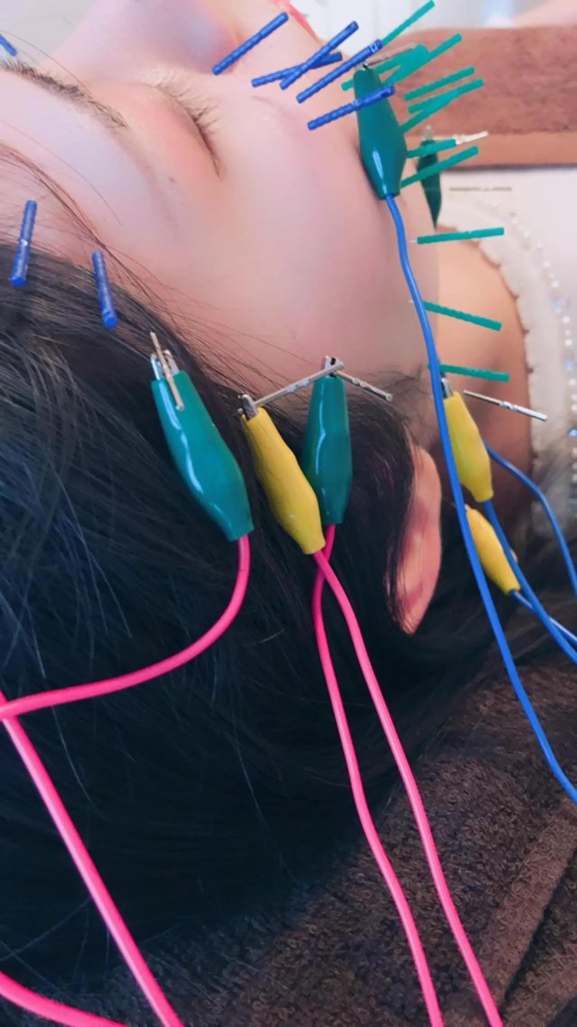 はりすたいる 鍼灸院のエステ・リラクイメージ