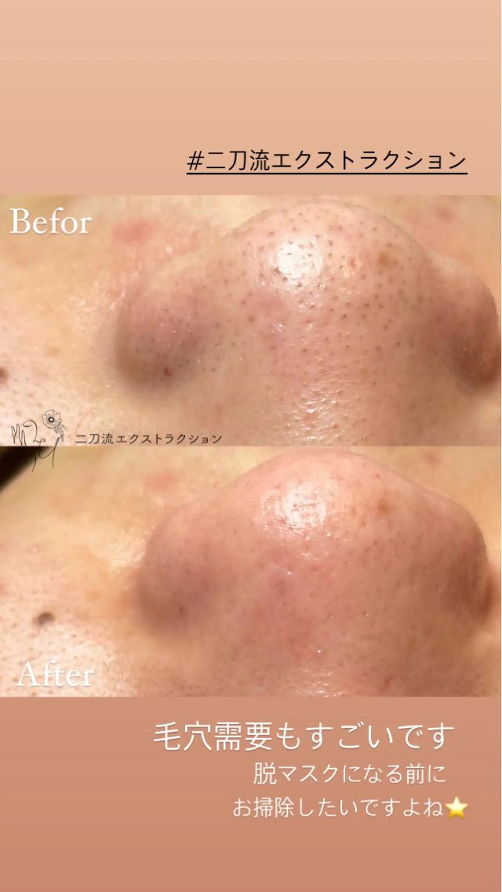 エステ リラク プライベートサロン emma【エマ】のその他イメージ