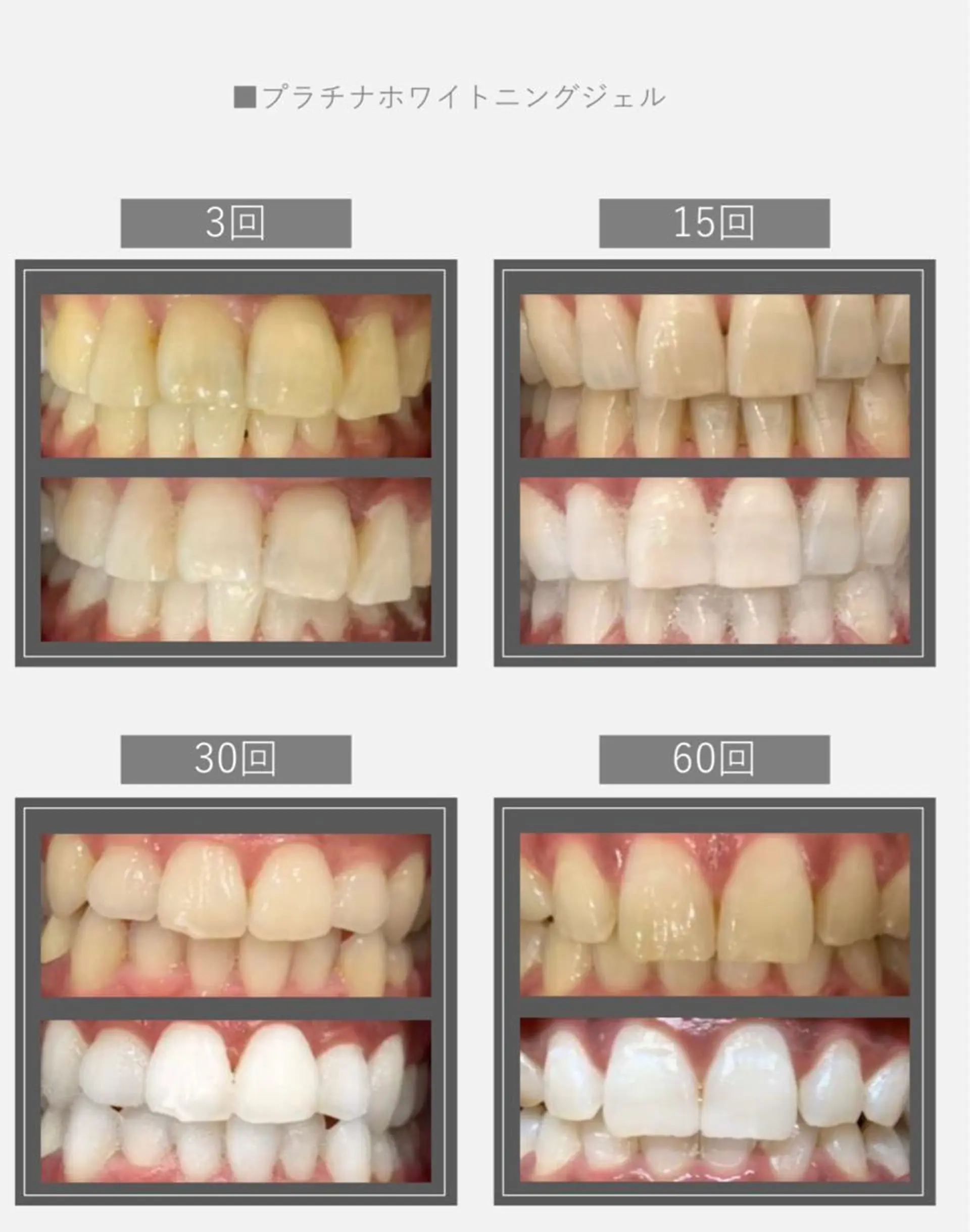 Monreve所属・美人スイッチdiet スーパージェクションのその他イメージ