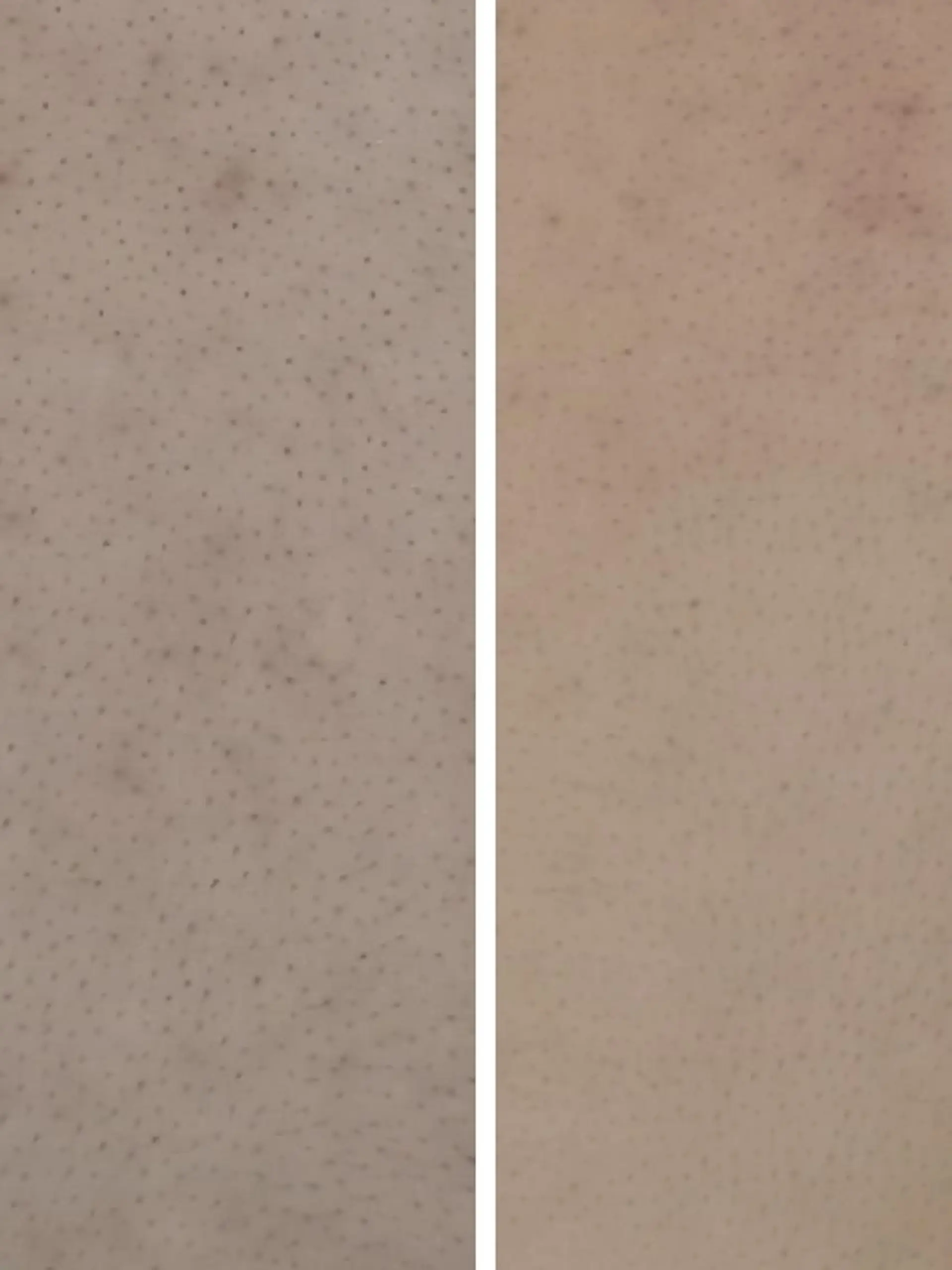 ナリストータルビューティーサロン岐阜所属・辻 恵理のエステ・リラクイメージ