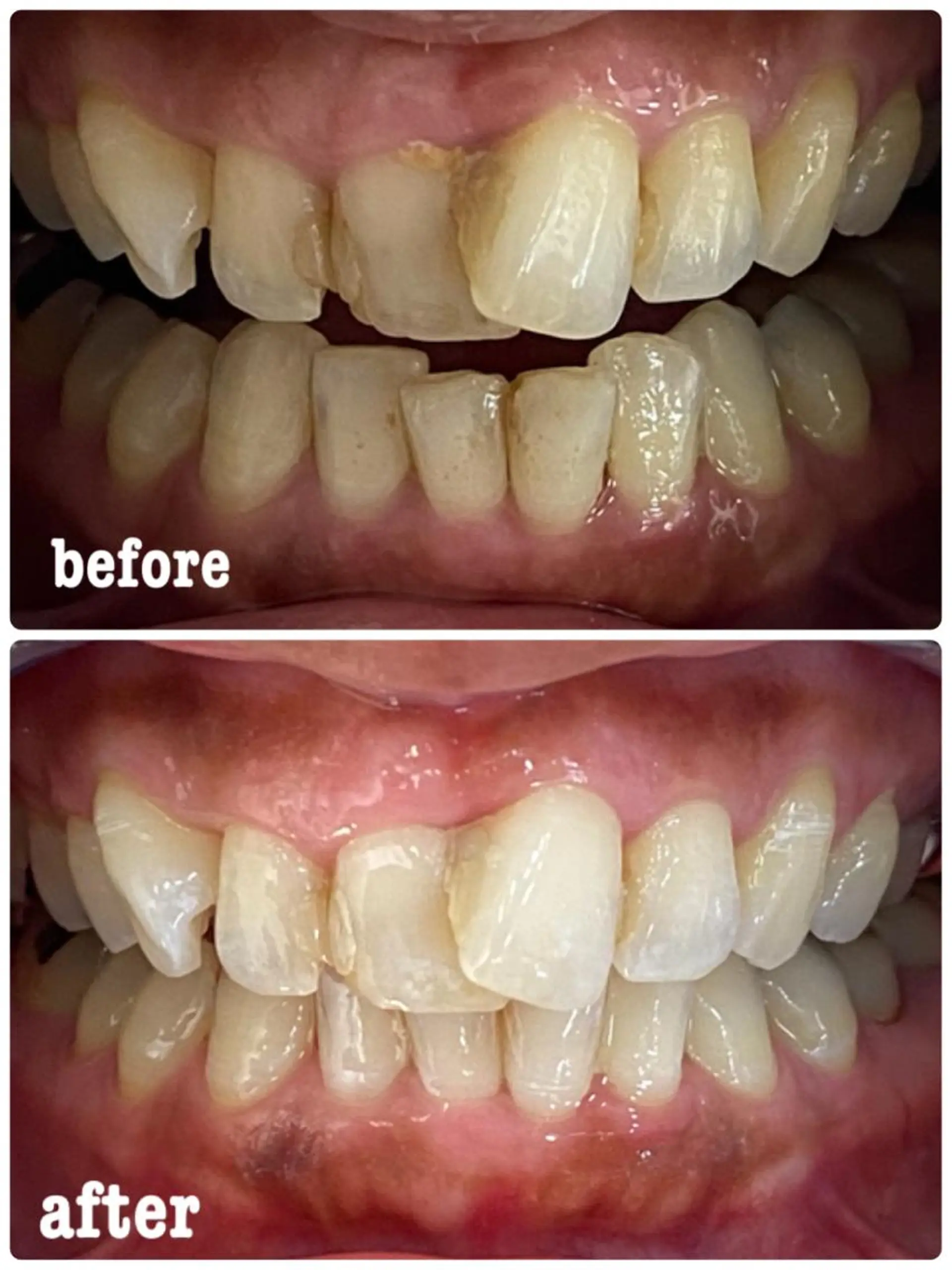 ホワイトニングサロン ラウレアのその他イメージ