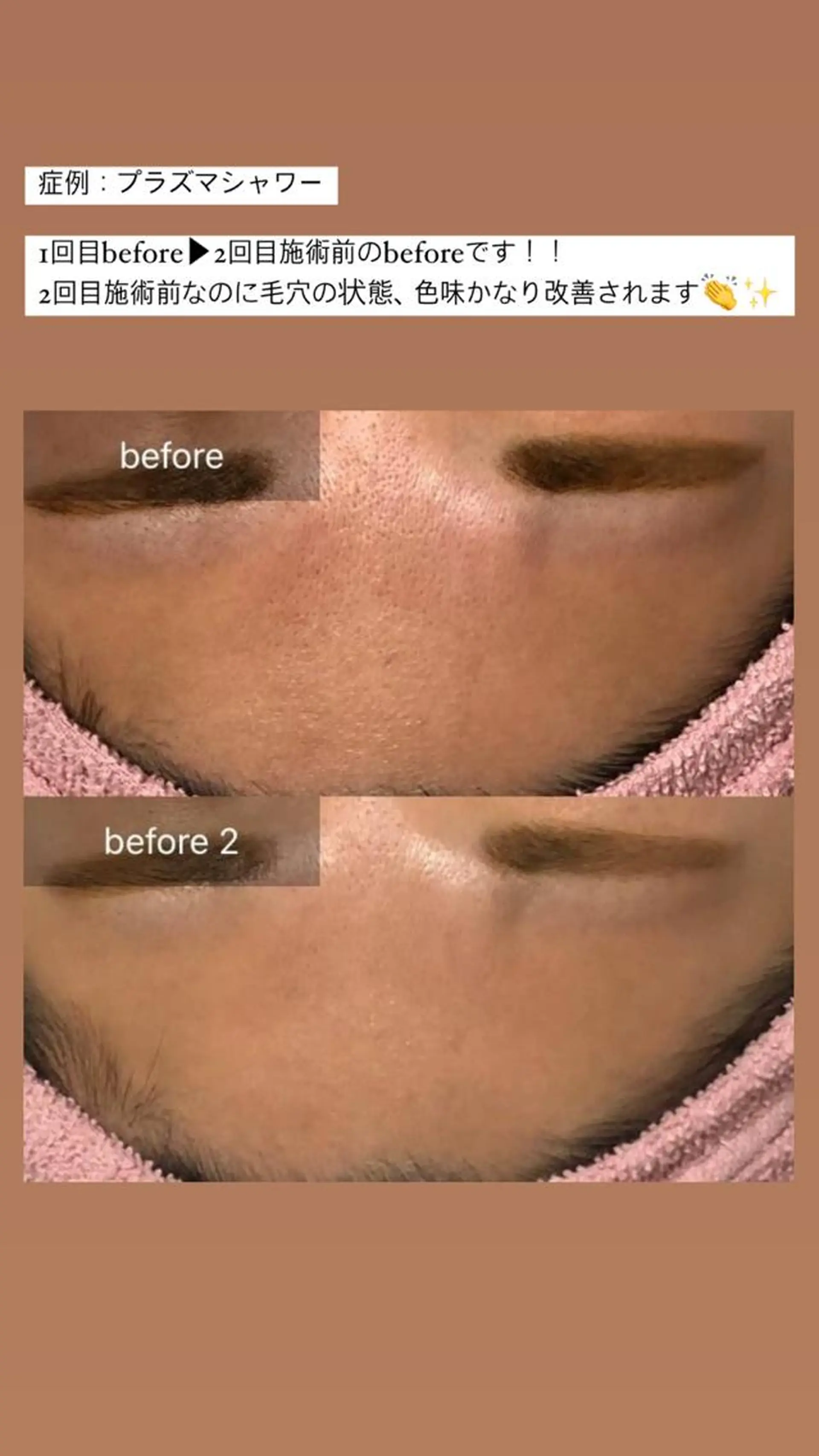 エステ リラク ALIA Scintiller  アリアサンティエ所属・齋藤 祐里耶のエステ・リラクイメージ