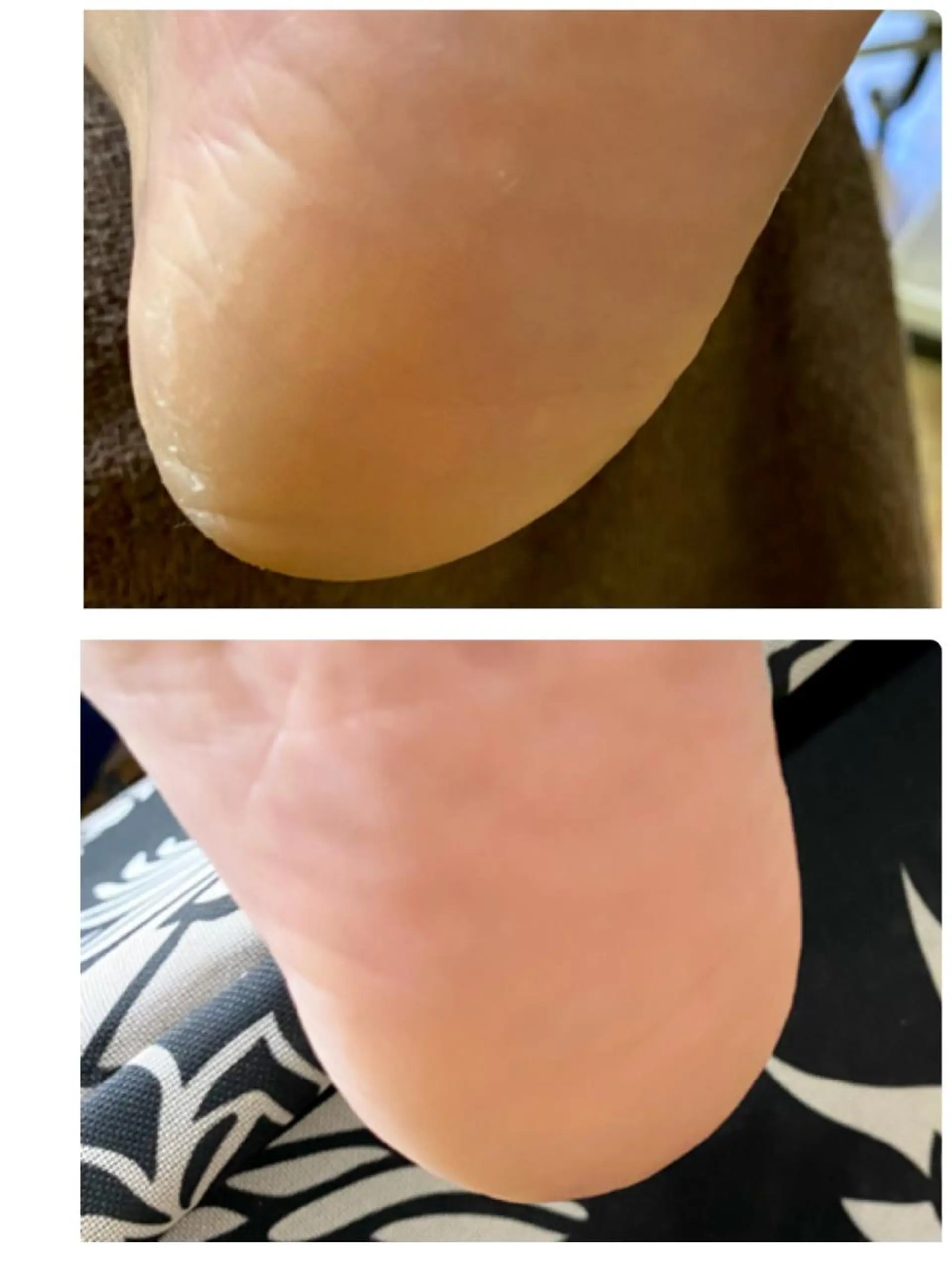 ネイル フットネイル ジェルネイル BABELバベル所属・江戸川橋✨BABEL 【バベル】大人可愛いのネイルデザイン