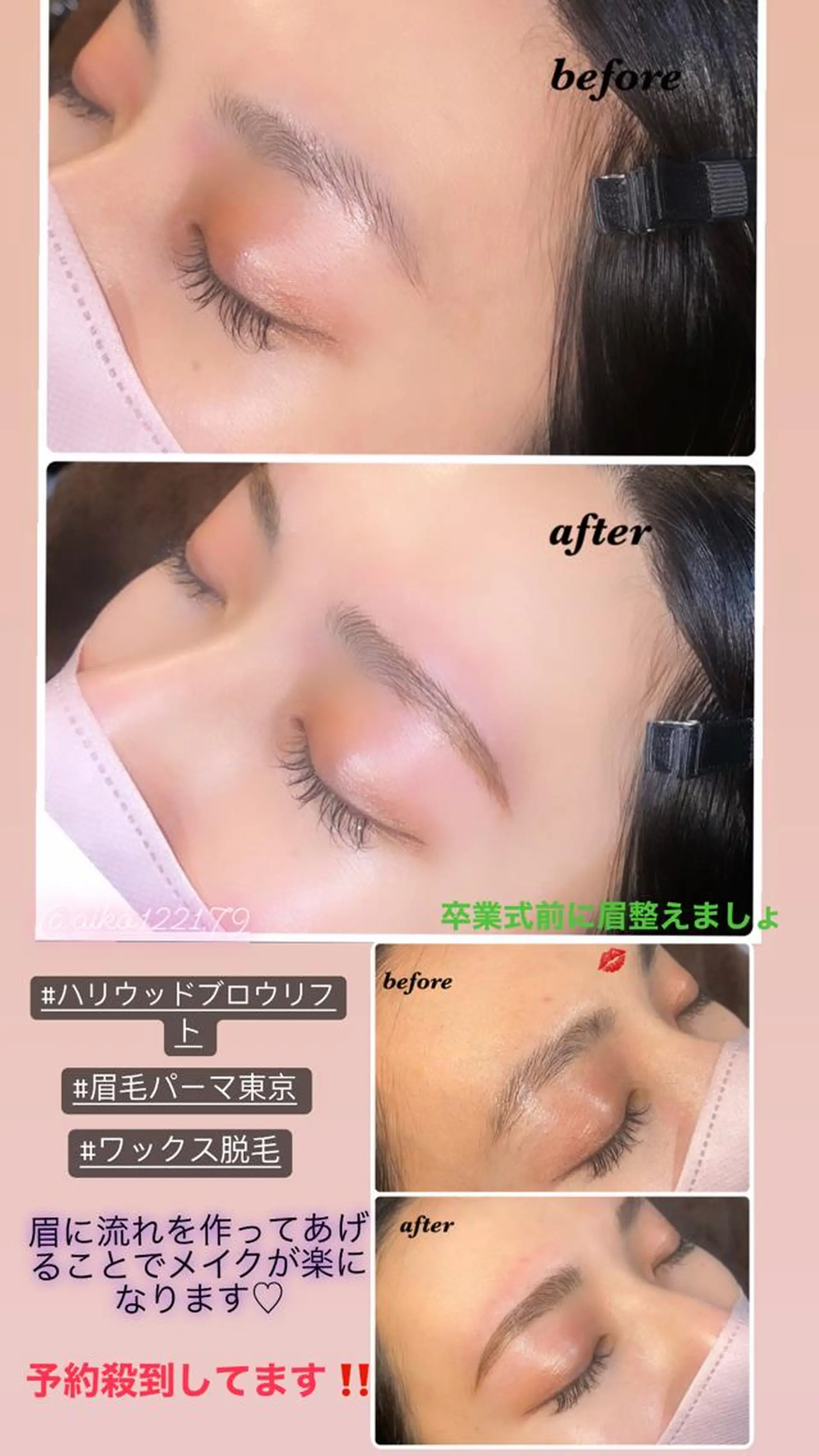 アイブロウ ハーブピーリング/韓国肌管理/フェイシャル/毛穴洗浄/眉毛/顔脱毛【糸脱毛専門】rev所属・ハーブピーリング🌹 毛穴洗浄❤️眉waxのエステ・リラクイメージ