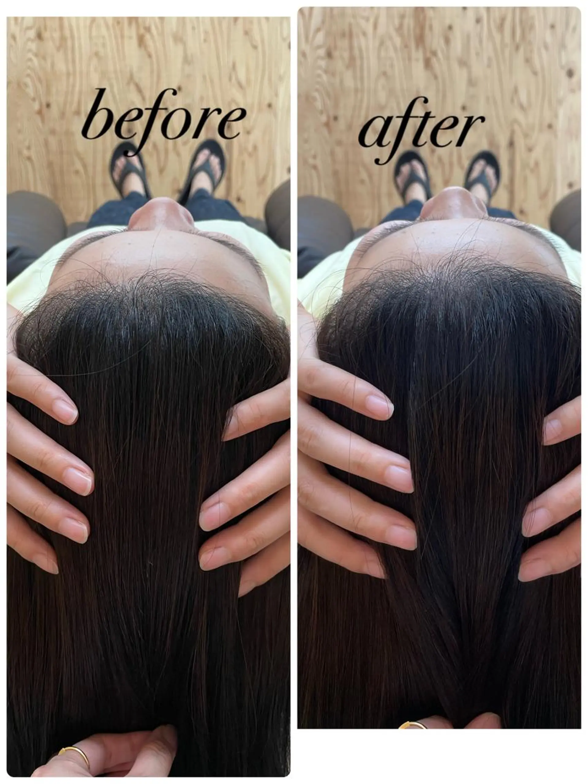 リラク ate'所属・個室ドライヘッドスパ 🍃moriのエステ・リラクイメージ