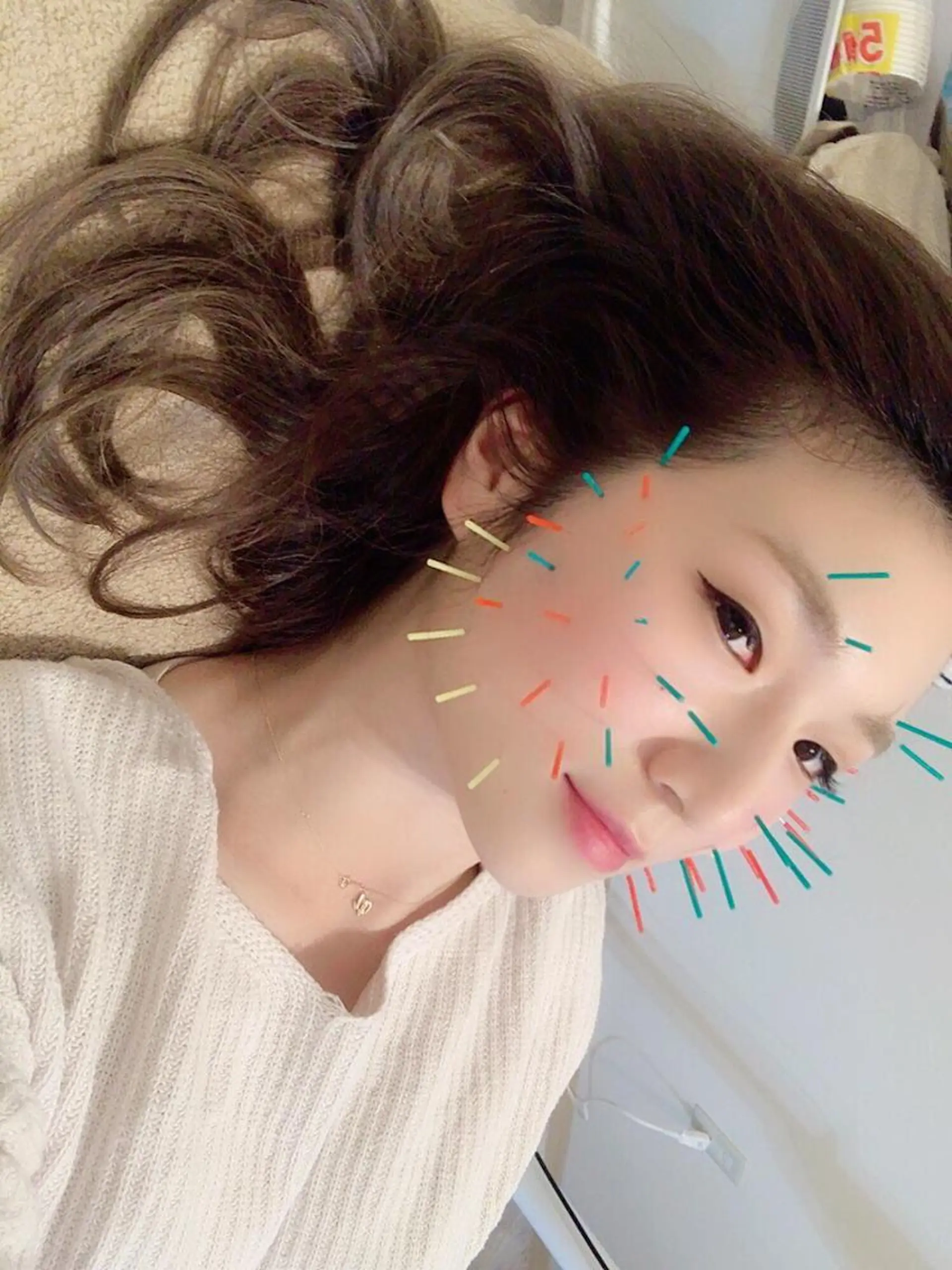 鍼灸整骨院Refine所属・鍼灸 Refineのその他イメージ