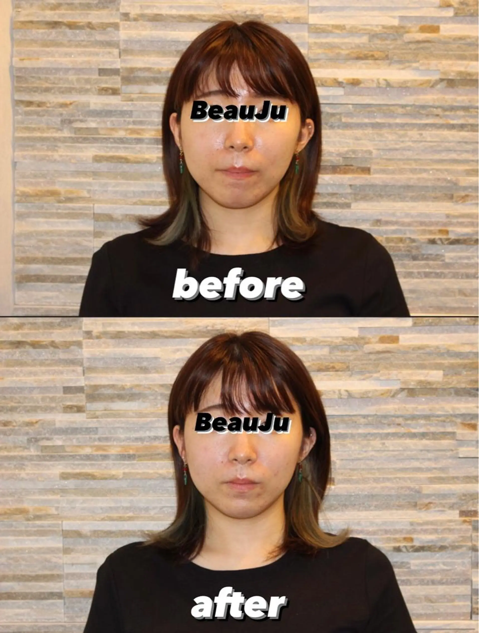 リラク 美容鍼灸整体サロンBeauJu所属・小顔矯/美容鍼/鍼灸 BeauJuのその他イメージ