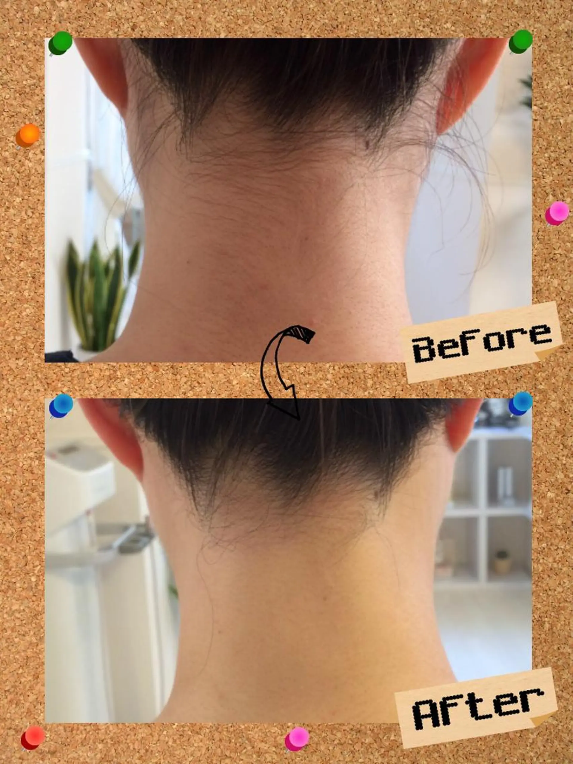 脱毛 大名 Kalon（カロン）のエステ・リラクイメージ