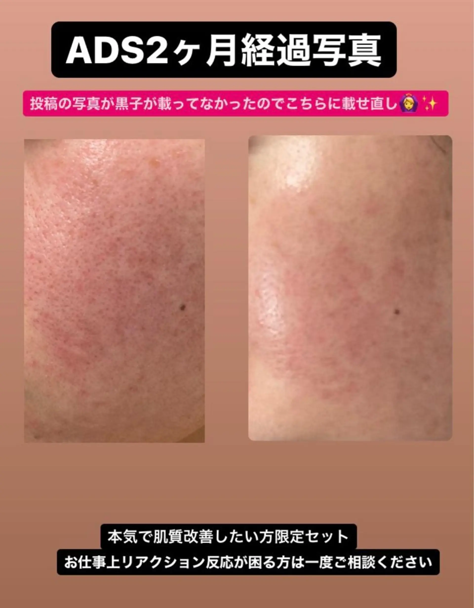 脱毛 &relaxation　M.EMINY所属・大分賀来リラクサロン M.EMINYのエステ・リラクイメージ