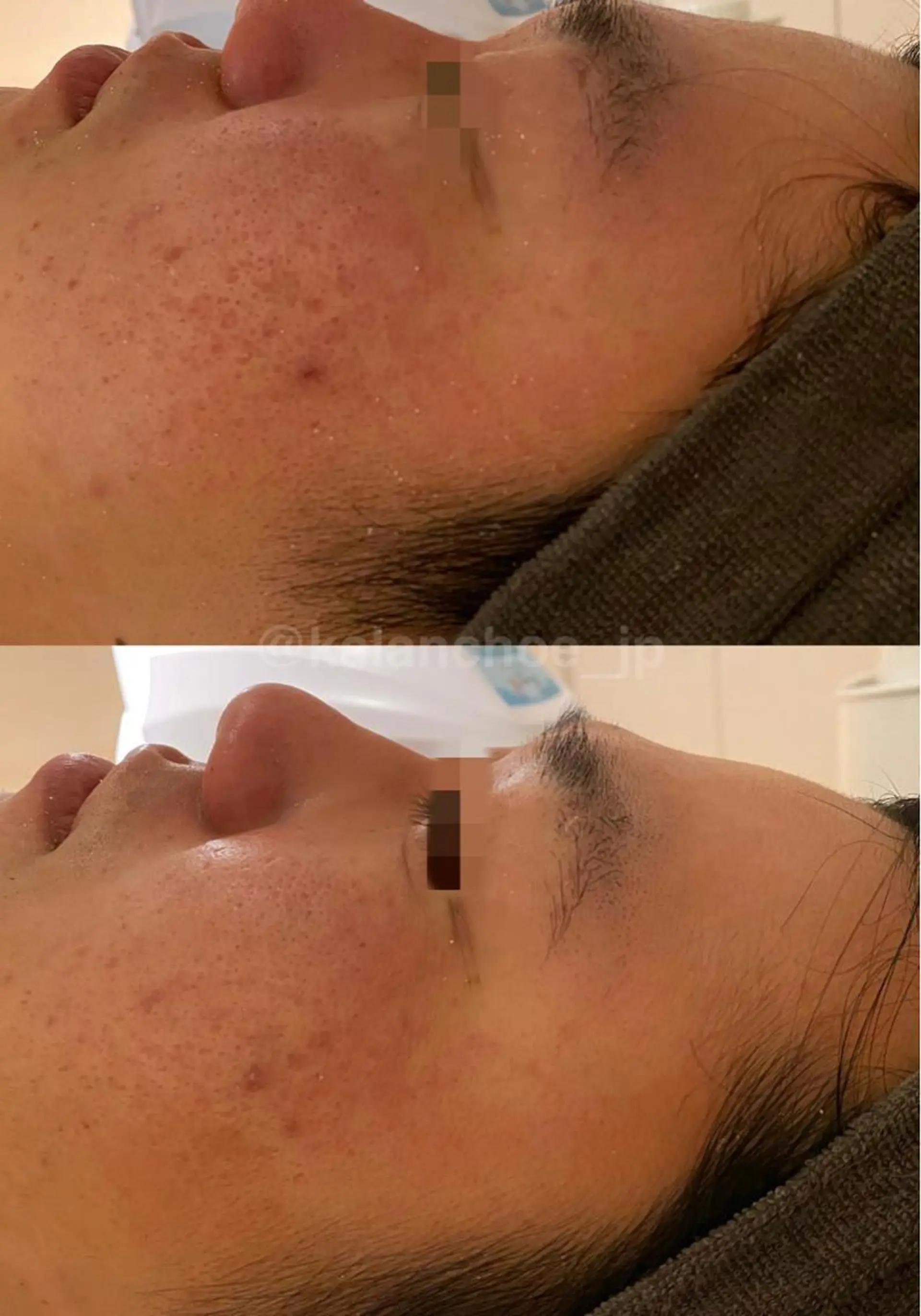 エステ 肌質改善 KALANCHOEのエステ・リラクイメージ