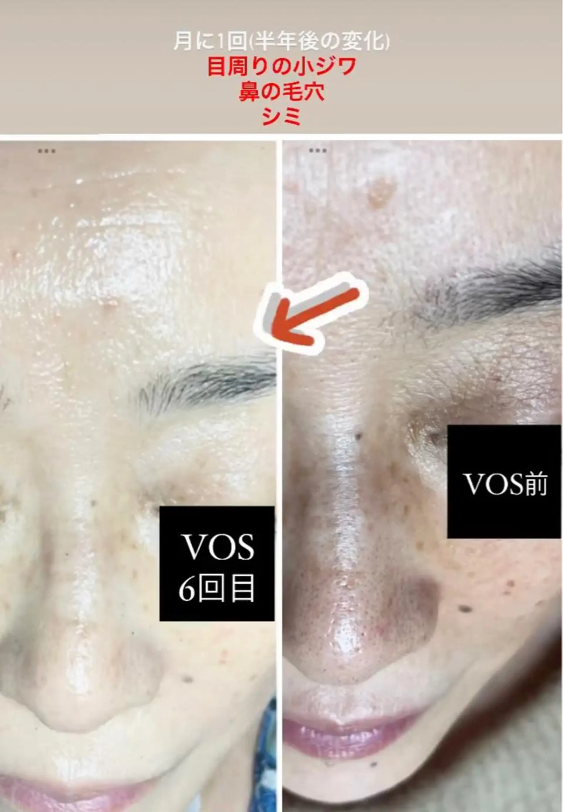 ネイル マツエク・マツパ アイブロウ 代表 MOMOのエステ・リラクイメージ