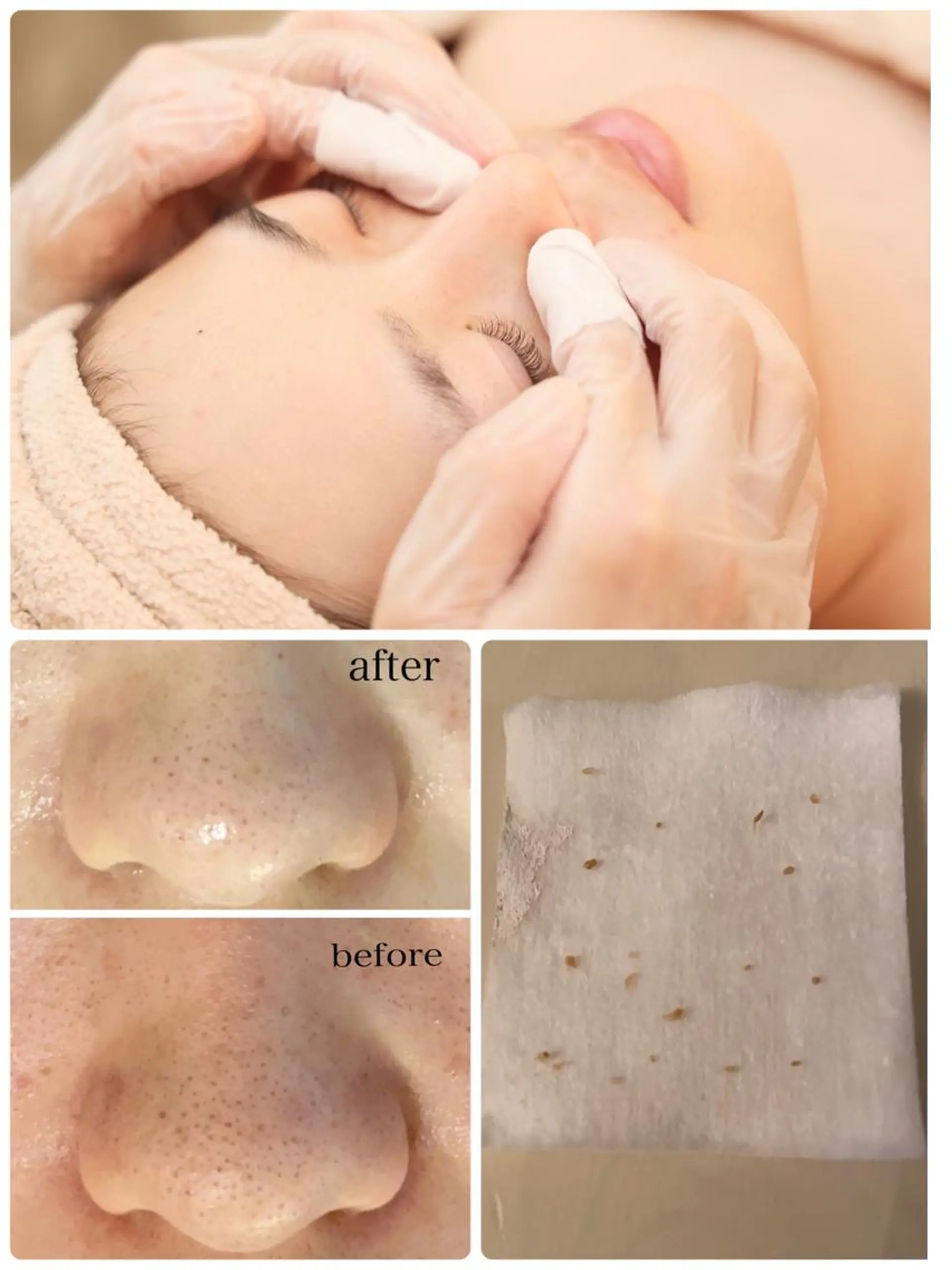 エステ 毛穴シミ改善専門 サロンド・ルパークのエステ・リラクイメージ