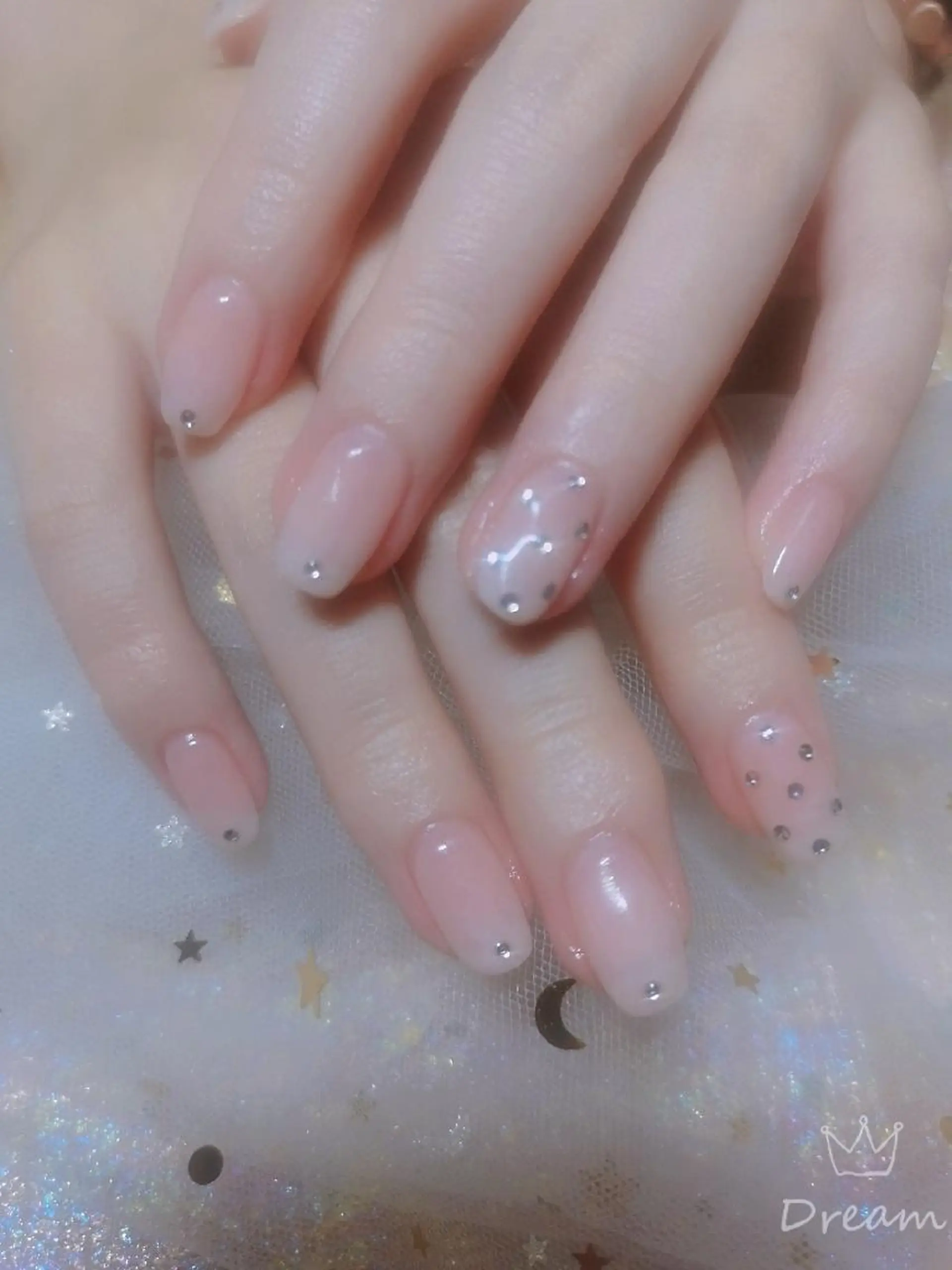 ネイル ハンドネイル ネイリストゆか💅 長さだし、深爪矯正のネイルデザイン