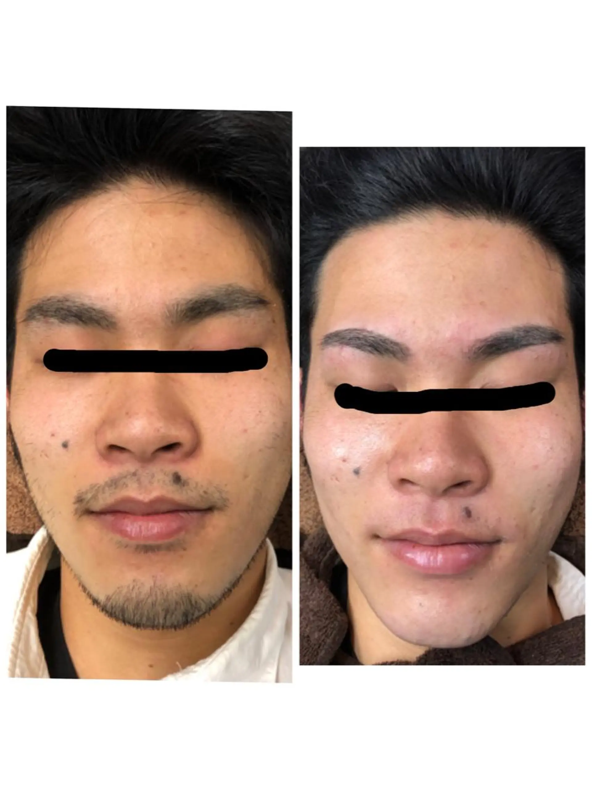 脱毛 兒玉 知代の眉毛・アイブロウイメージ