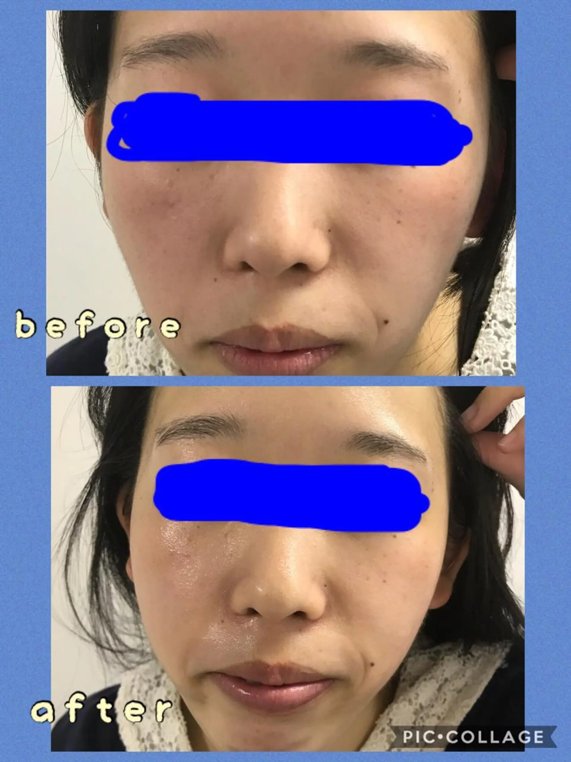 エステ *Lien* リアンのエステ・リラクイメージ