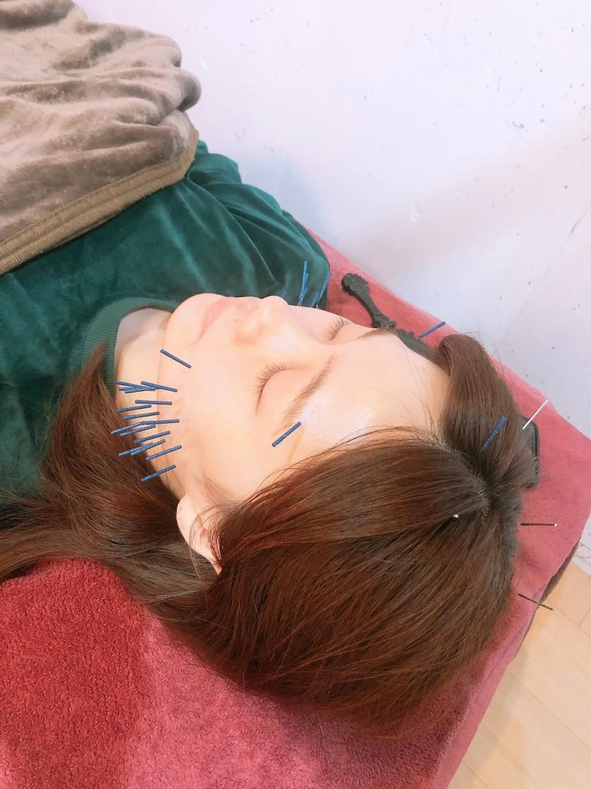 美容鍼灸女性専用 りんご鍼灸治療院のエステ・リラクイメージ