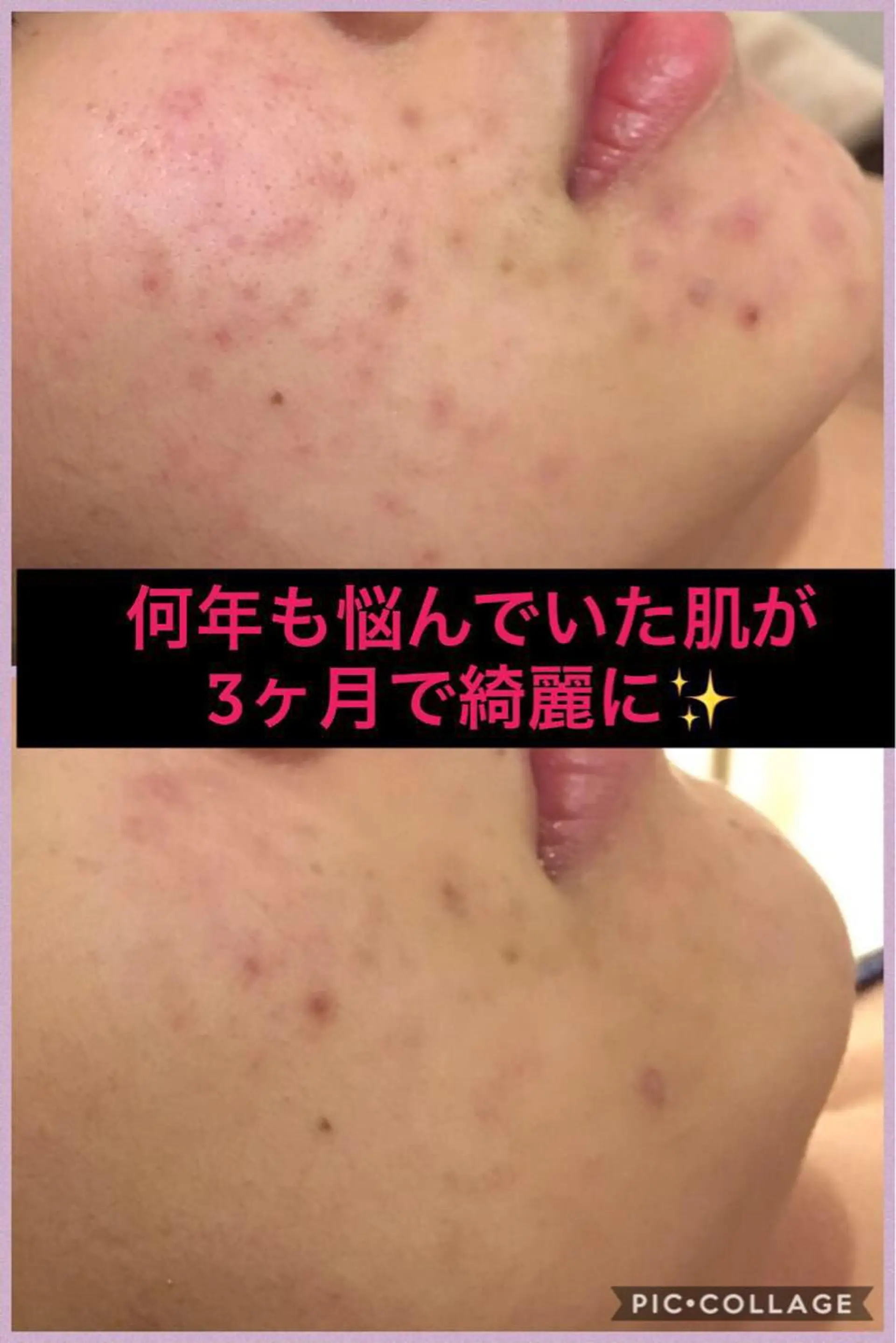 ミディアム カラー パーマ ヘアアレンジ メンズ キッズ ネイル マツエク・マツパ ニキビ・肌質改善専門 ♡人生が変わるサロンのエステ・リラクイメージ