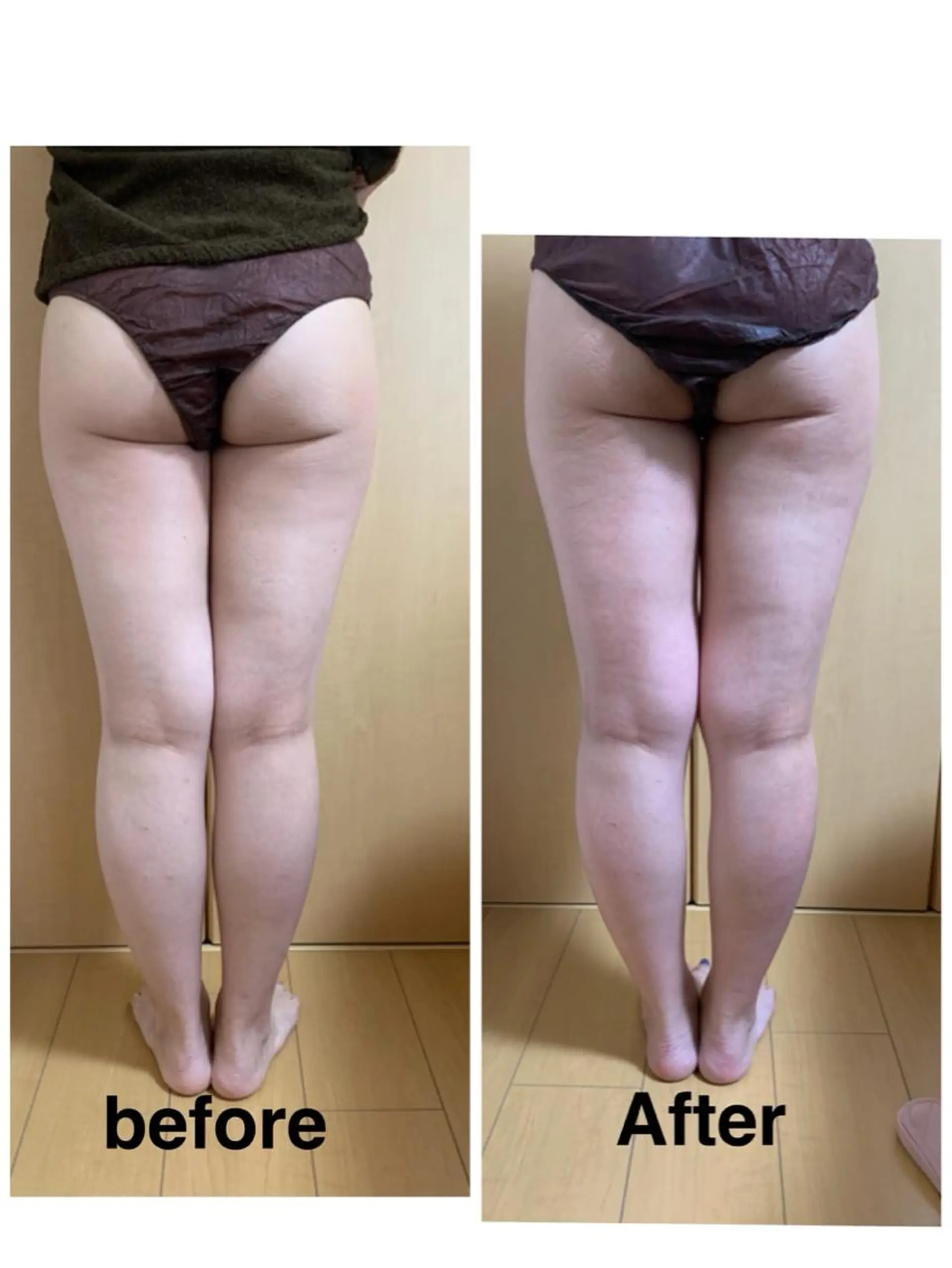 エステ リラク 痩身/脱毛/ネイル HARUKAのエステ・リラクイメージ