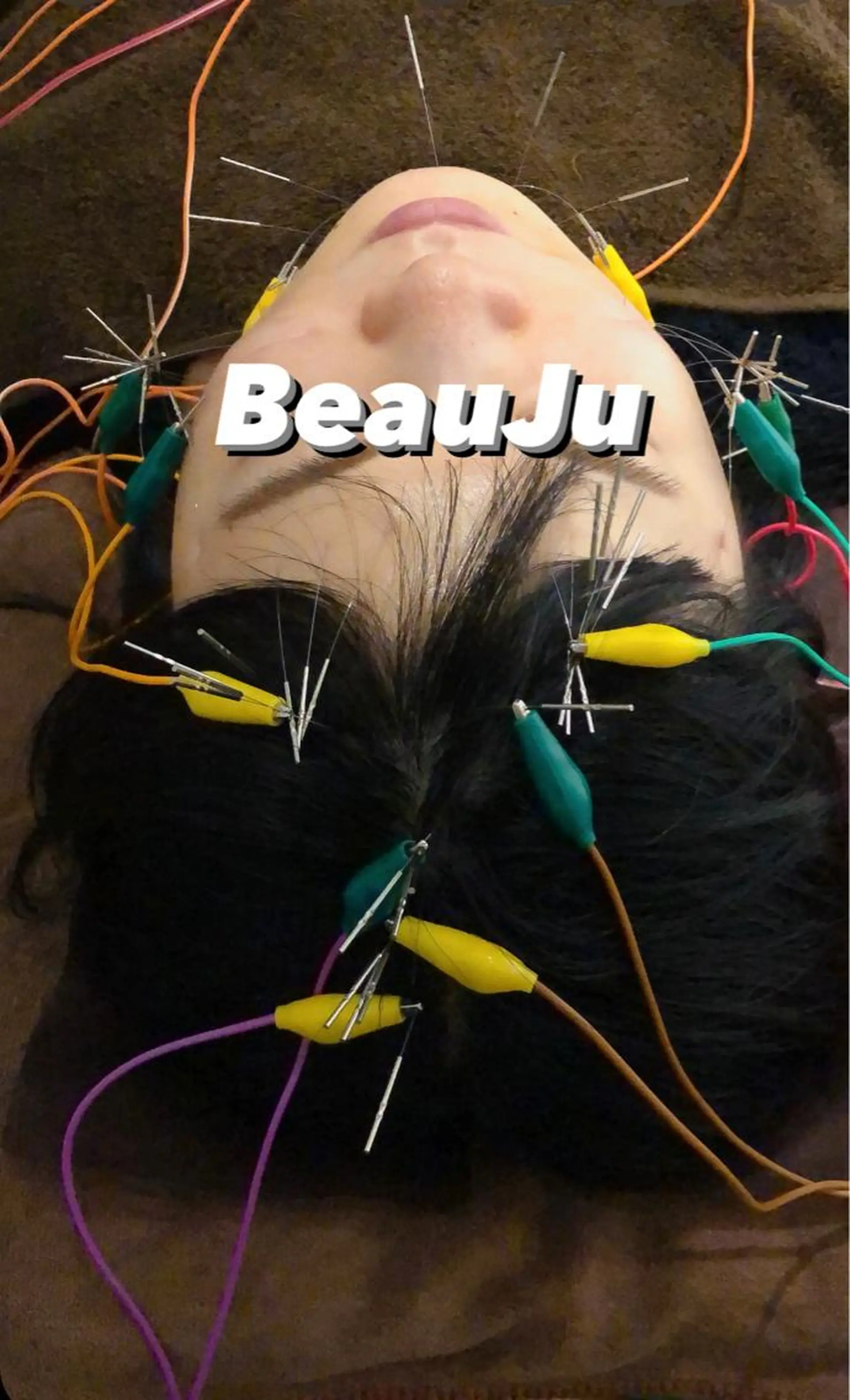 その他 美容鍼灸整体サロンBeauJu所属・小顔矯/美容鍼/鍼灸 BeauJuのその他イメージ