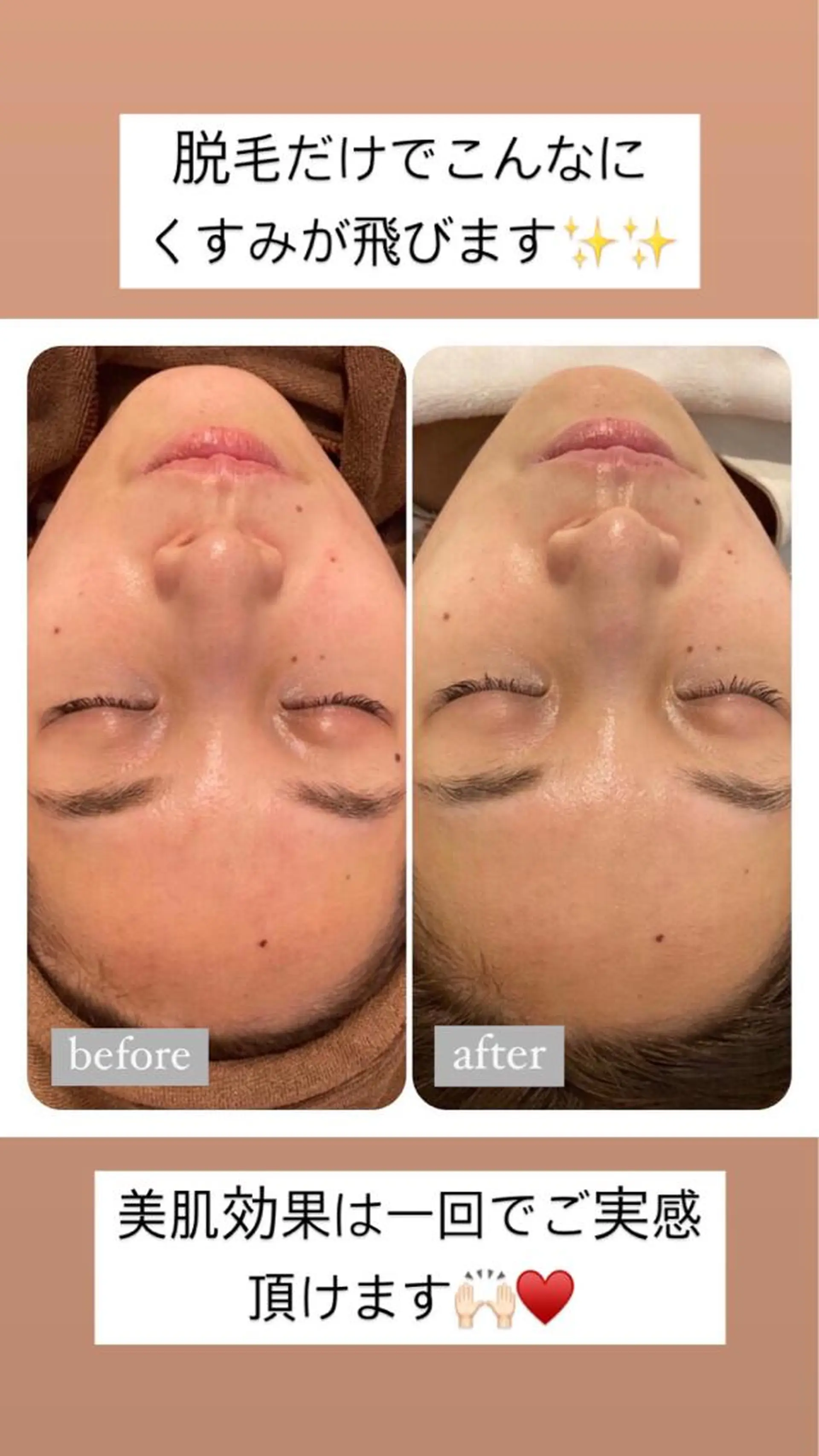 脱毛 美肌脱毛専門サロン Dione栄店のエステ・リラクイメージ