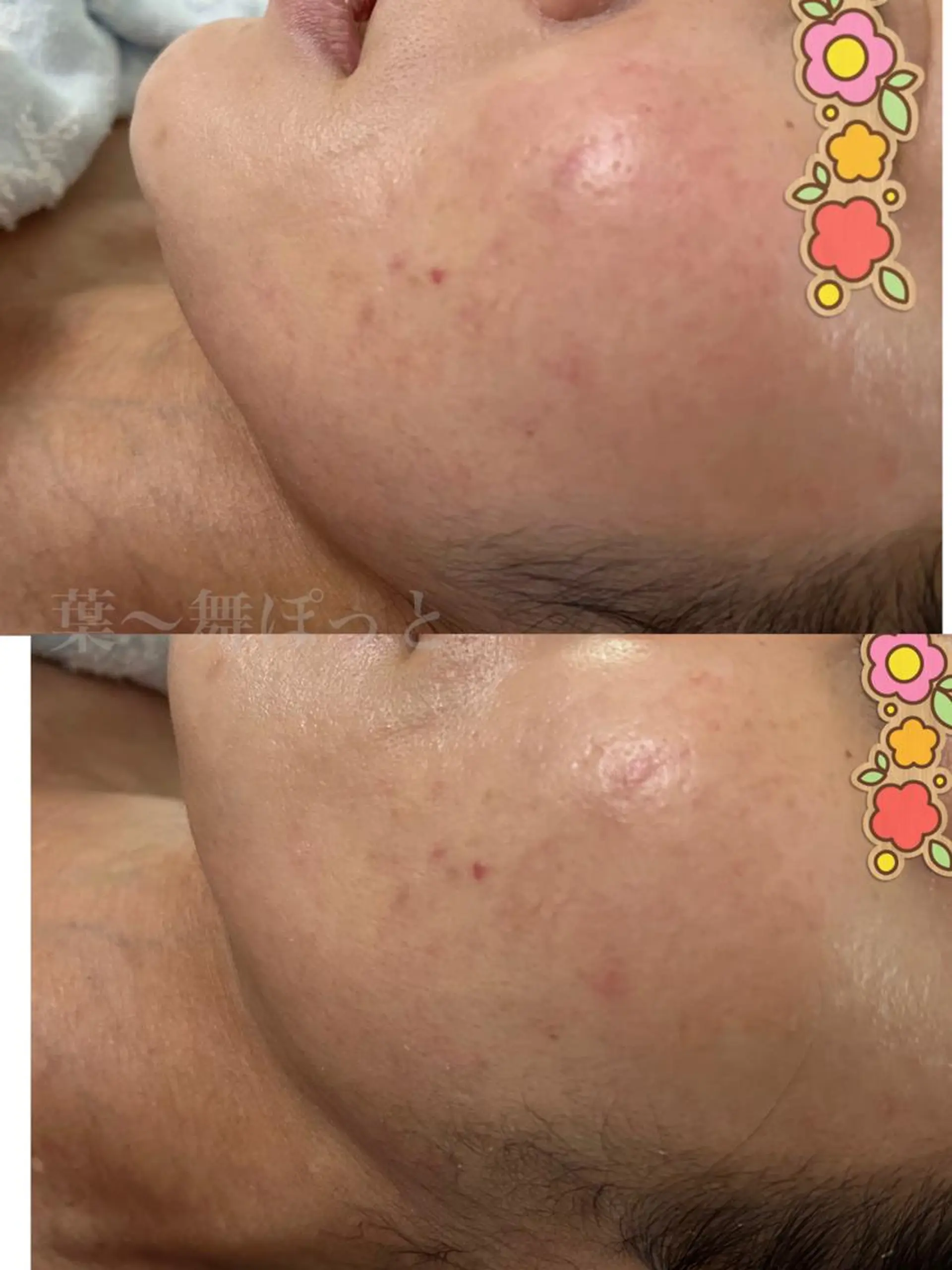 うえつま ふみえのエステ・リラクイメージ