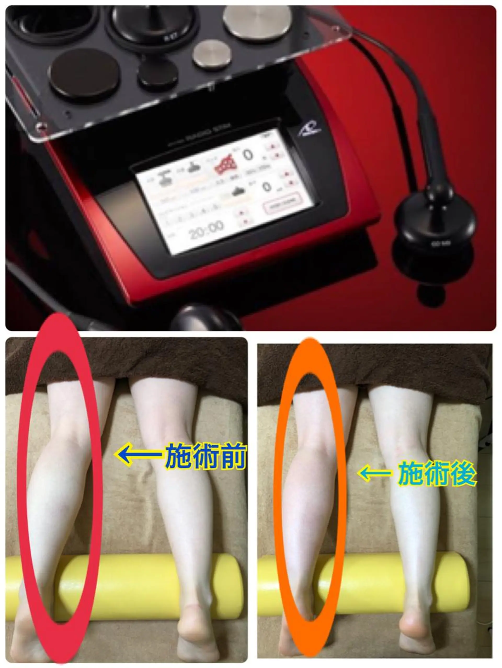 リラク ボディ・メンテ【フロー】所属・ボディ・メンテ フローのエステ・リラクイメージ