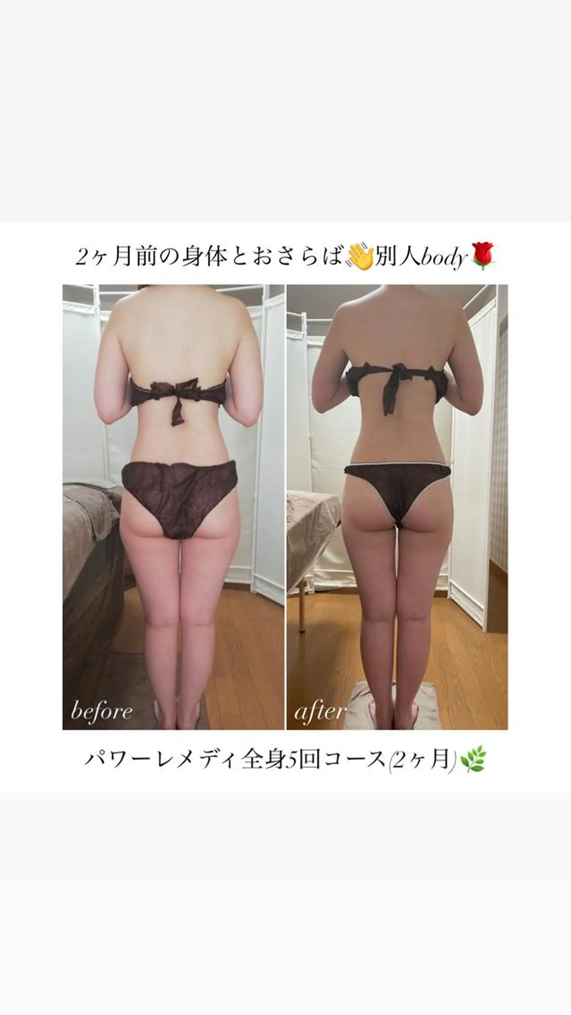 biloop所属・《痩身×疲労改善》 BILOOPのエステ・リラクイメージ