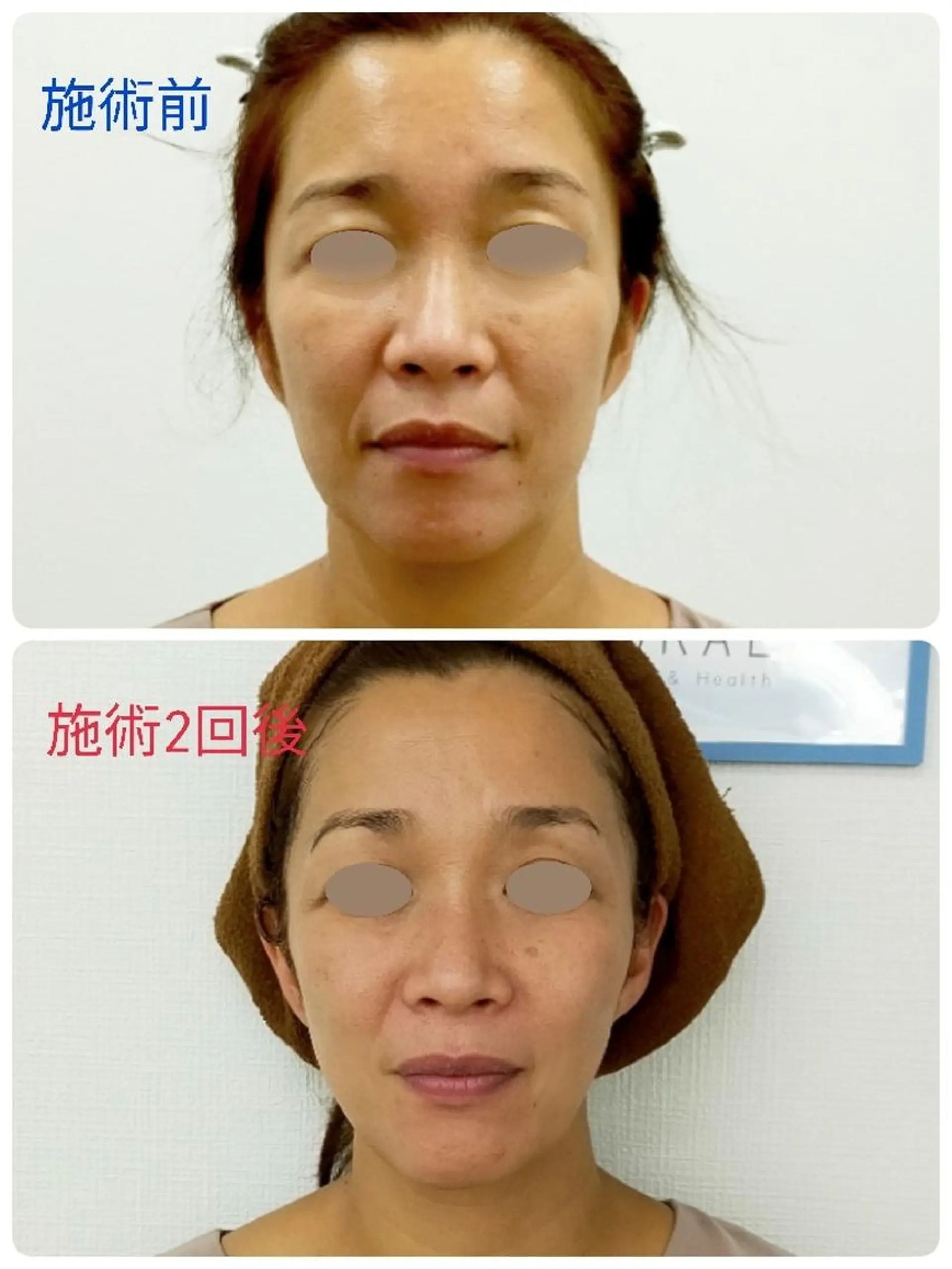 エステ リラク CORAL湘南平塚店所属・【小顔・美容専門】 🐠リカのエステ・リラクイメージ