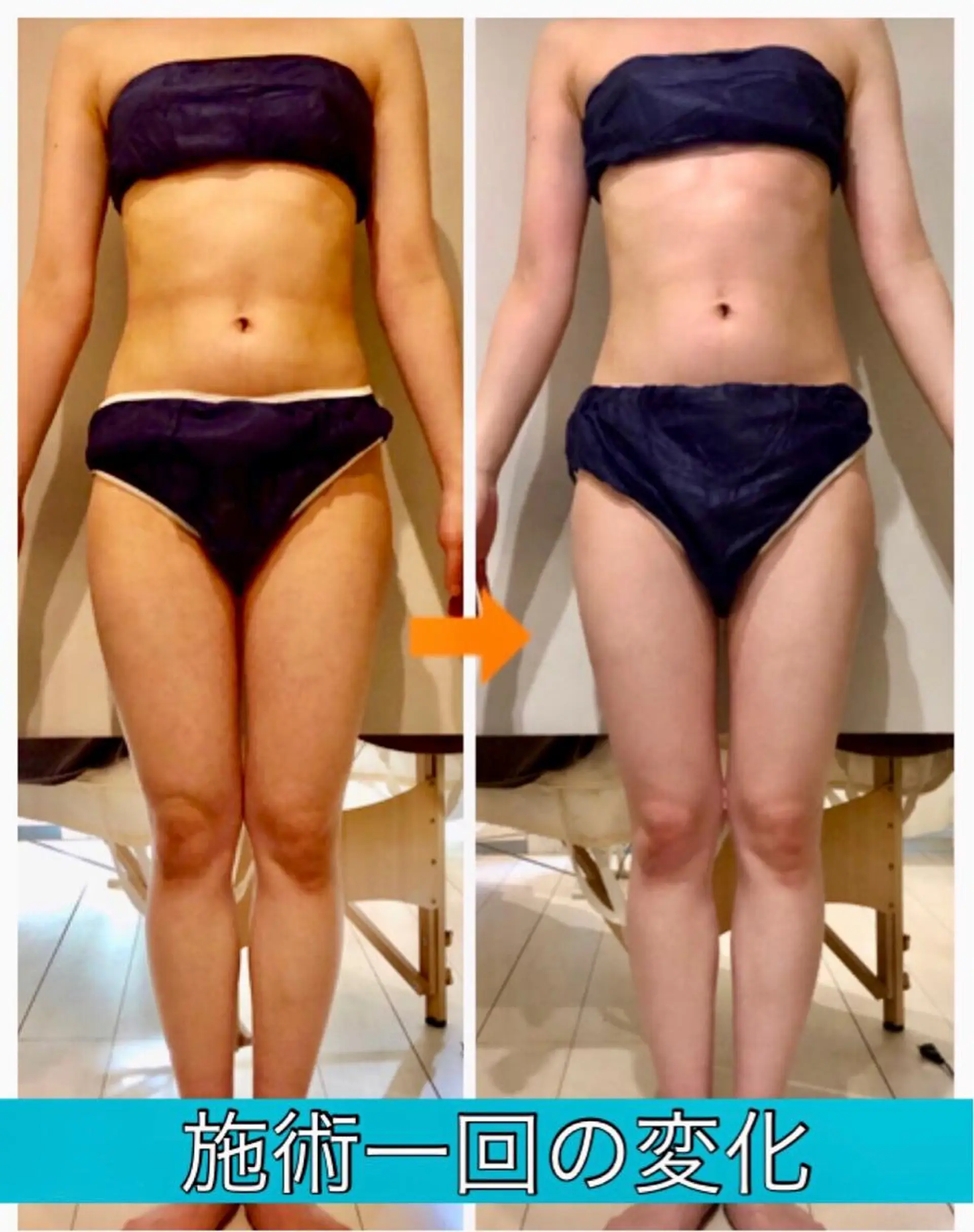 ロング カラー パーマ ヘアアレンジ メンズ キッズ ネイル マツエク・マツパ ‍痩身＆ボディ 結果出し🌟丹野のエステ・リラクイメージ