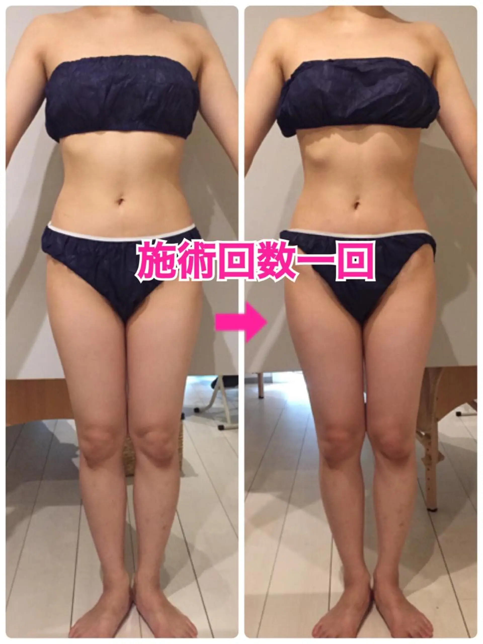 ショート カラー パーマ ヘアアレンジ メンズ キッズ ネイル マツエク・マツパ ‍痩身＆ボディ 結果出し🌟丹野のエステ・リラクイメージ