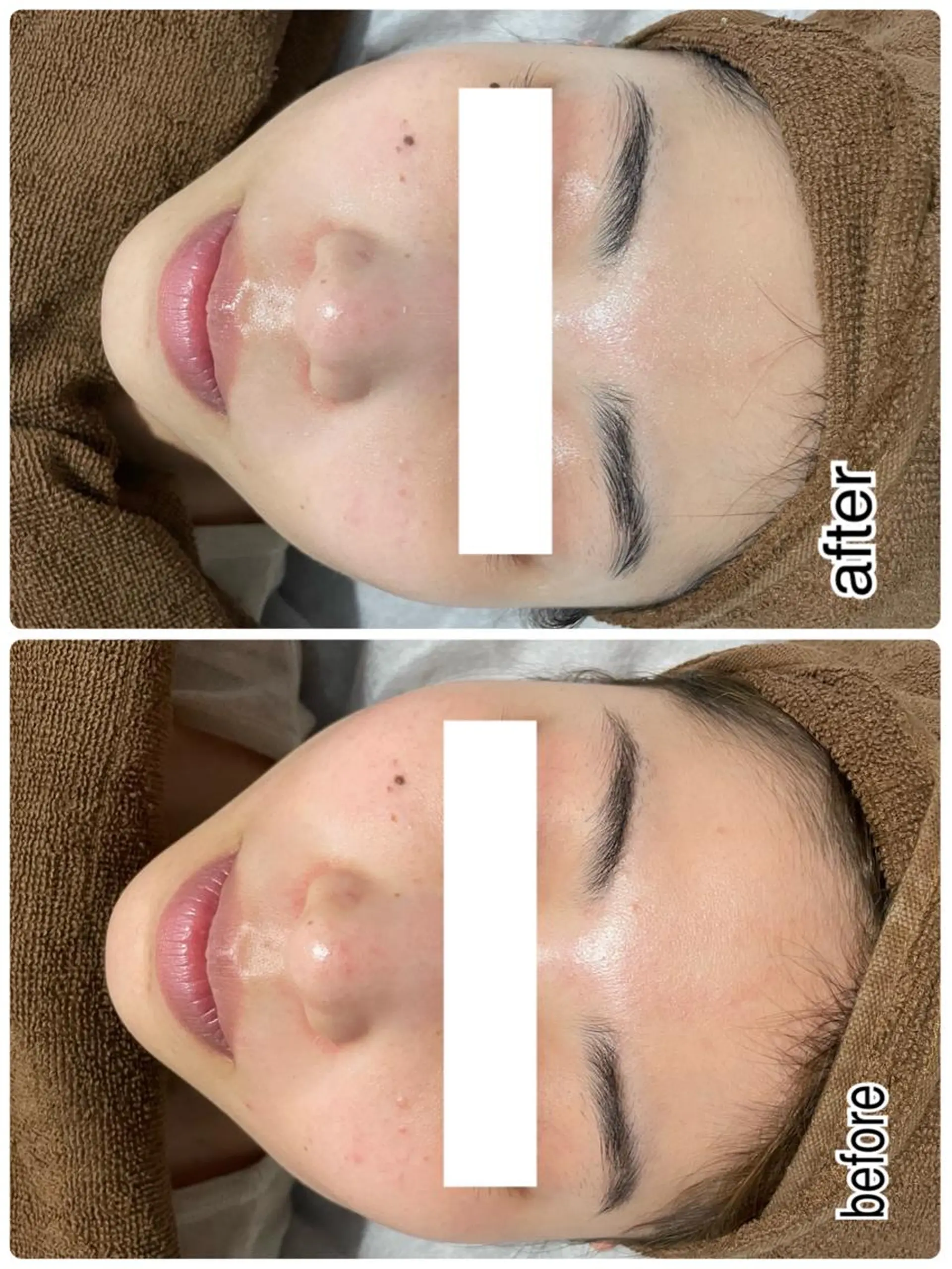 エステ ENCHANT 脱毛.小顔.毛穴のエステ・リラクイメージ