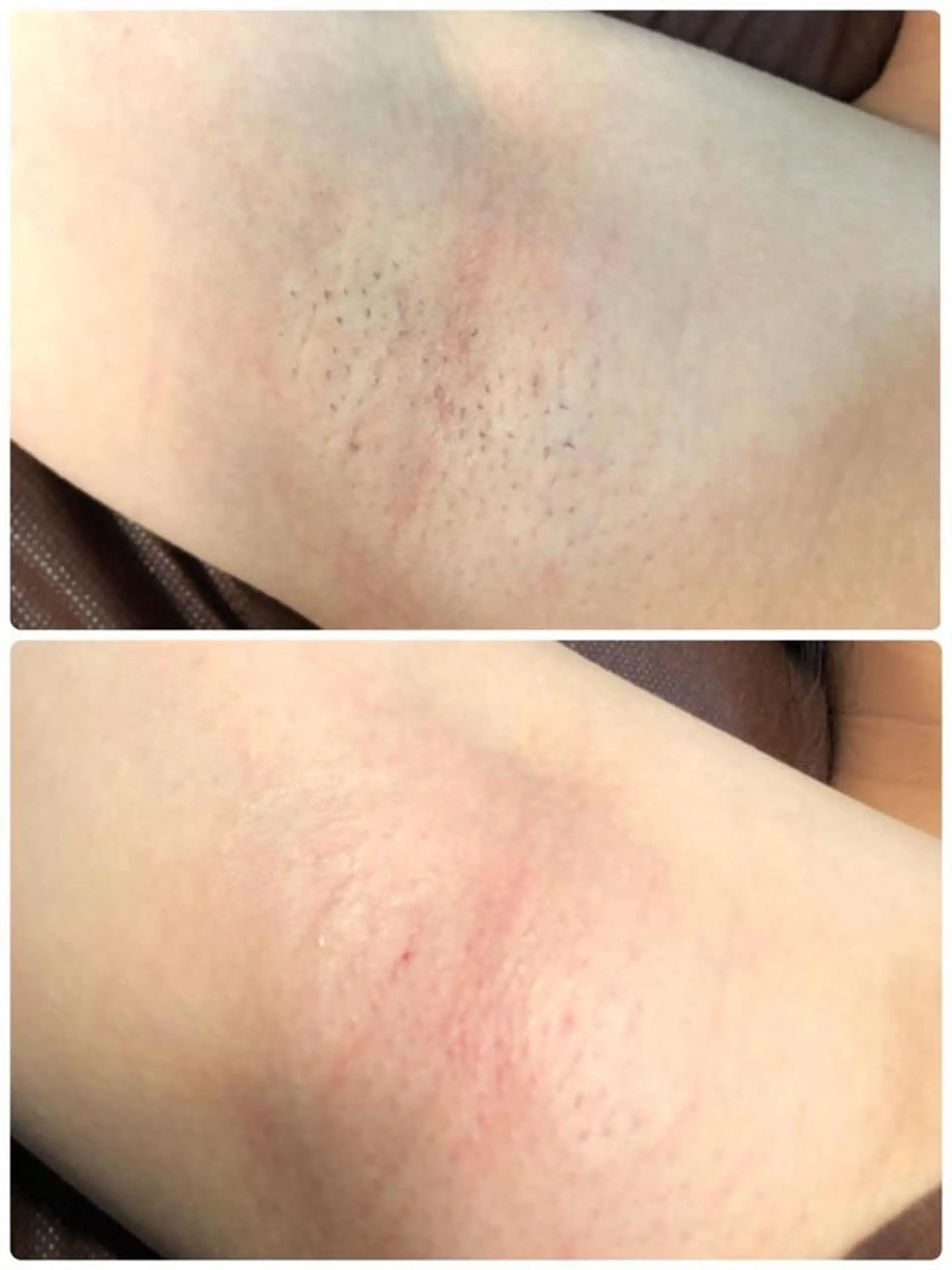 脱毛 兒玉 知代の眉毛・アイブロウイメージ