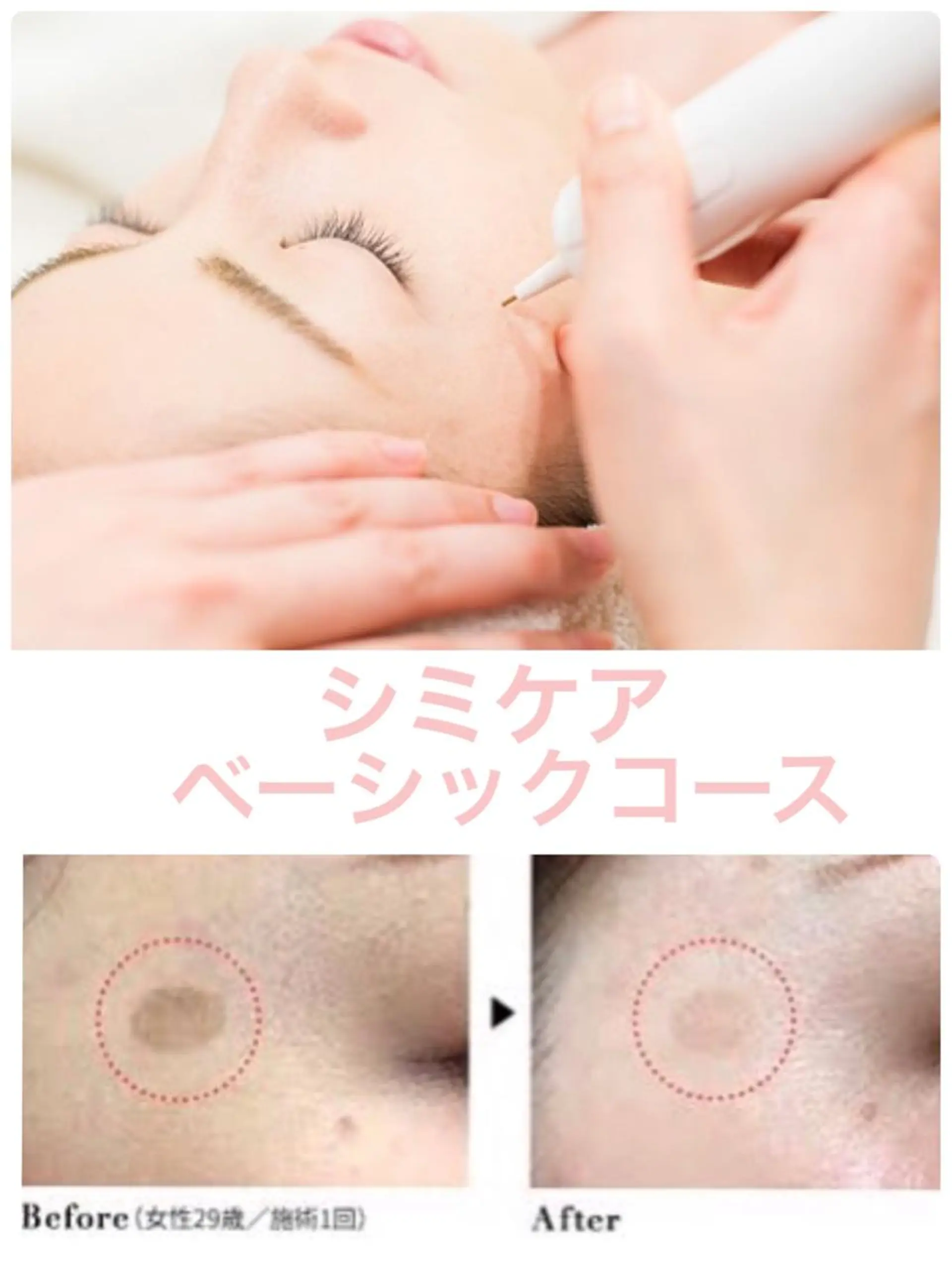 肌質改善サロン BestBelleのエステ・リラクイメージ