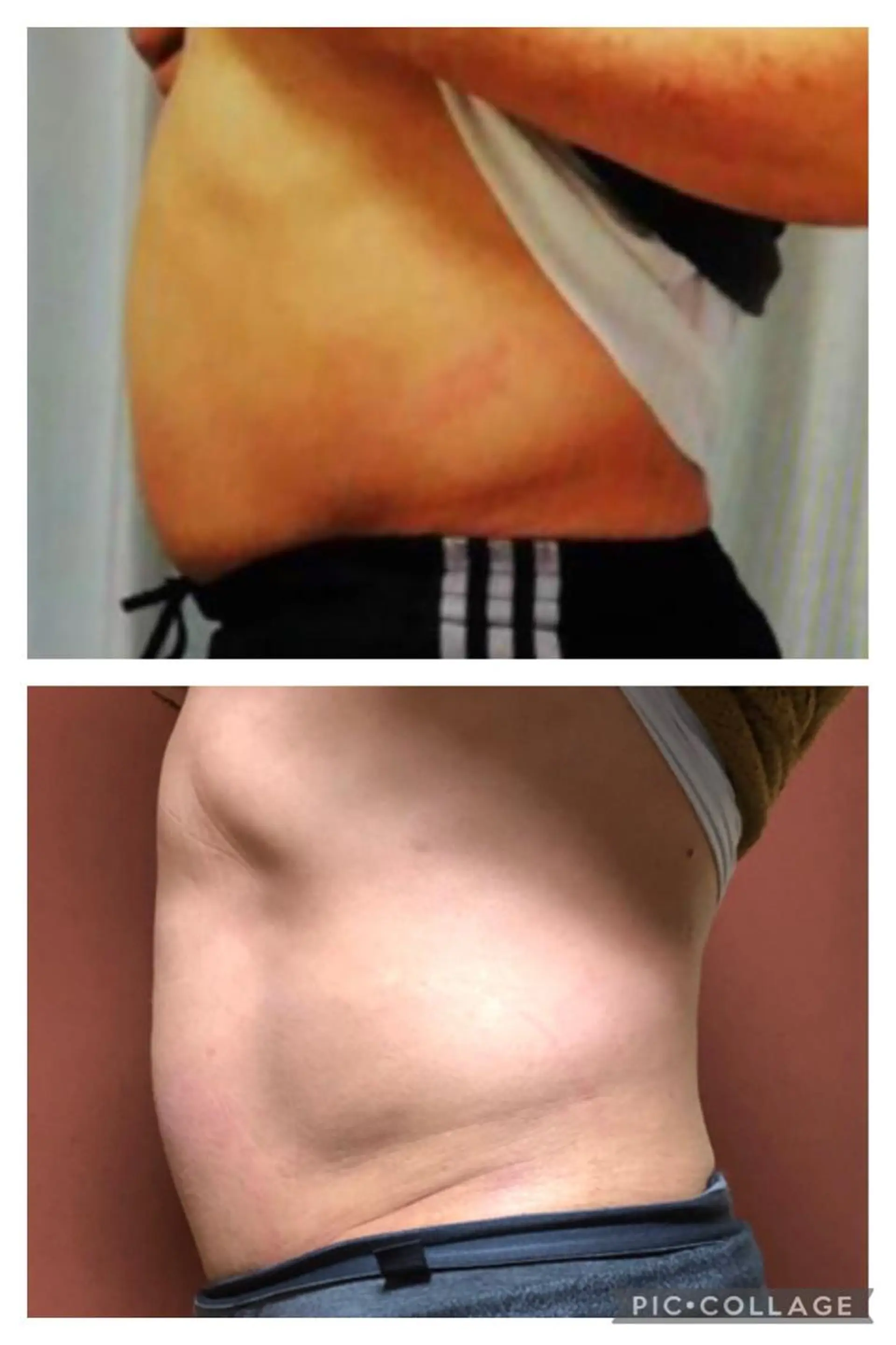 【肩こり】【腰痛】癒しのボディメンテサロンBMS金沢所属・野村 千代美のエステ・リラクイメージ