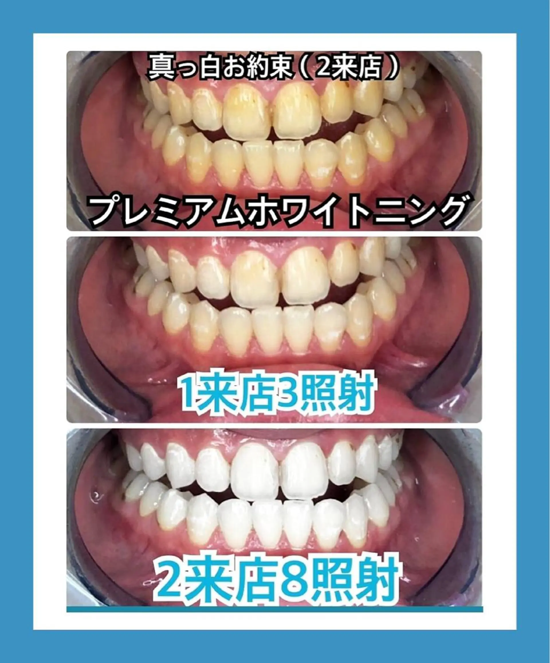 PLATINUM Beauty 横浜店所属・ホワイトニングルーム 横浜店のその他イメージ