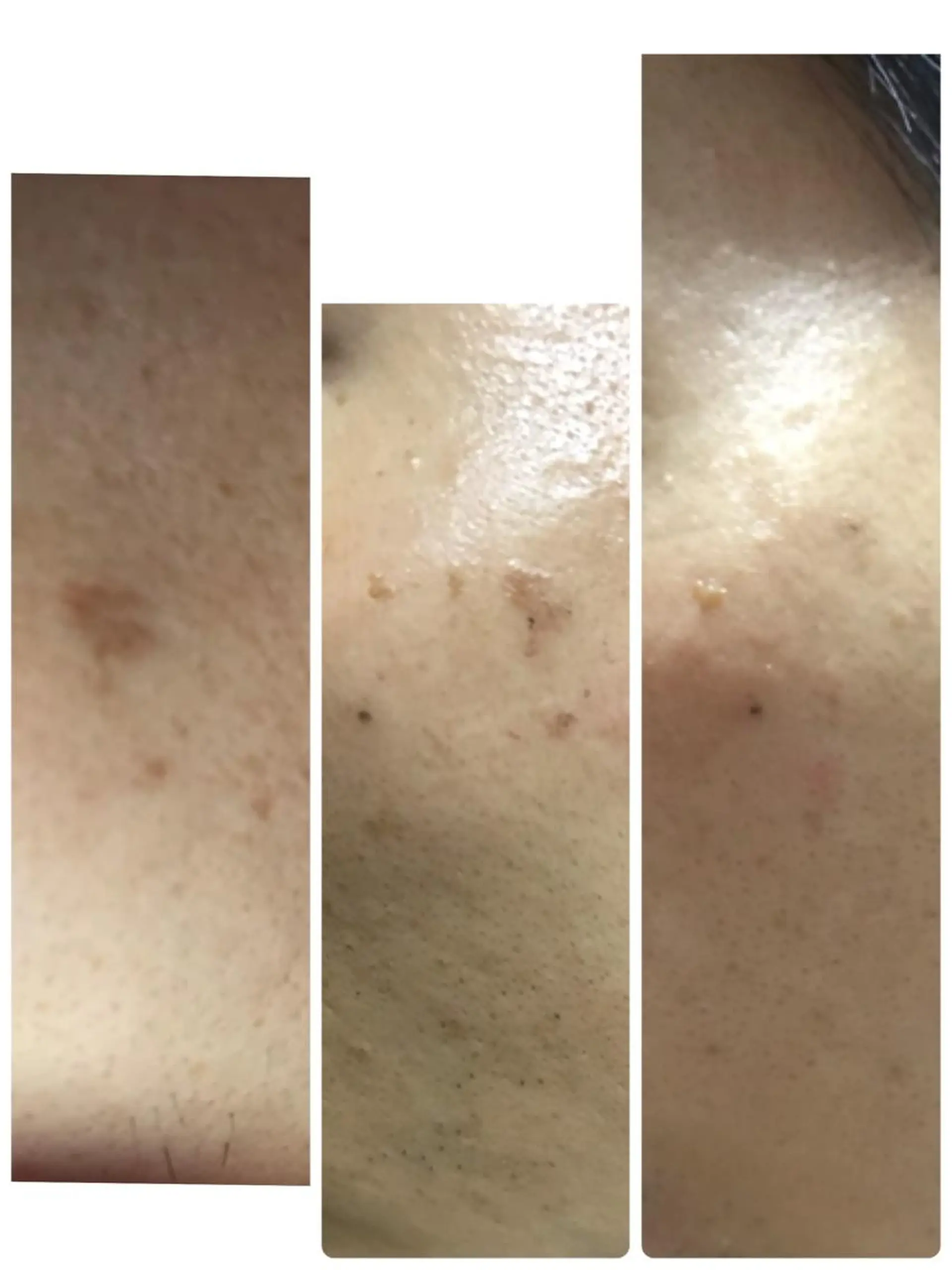 トータルエステサロン Tiaraのエステ・リラクイメージ