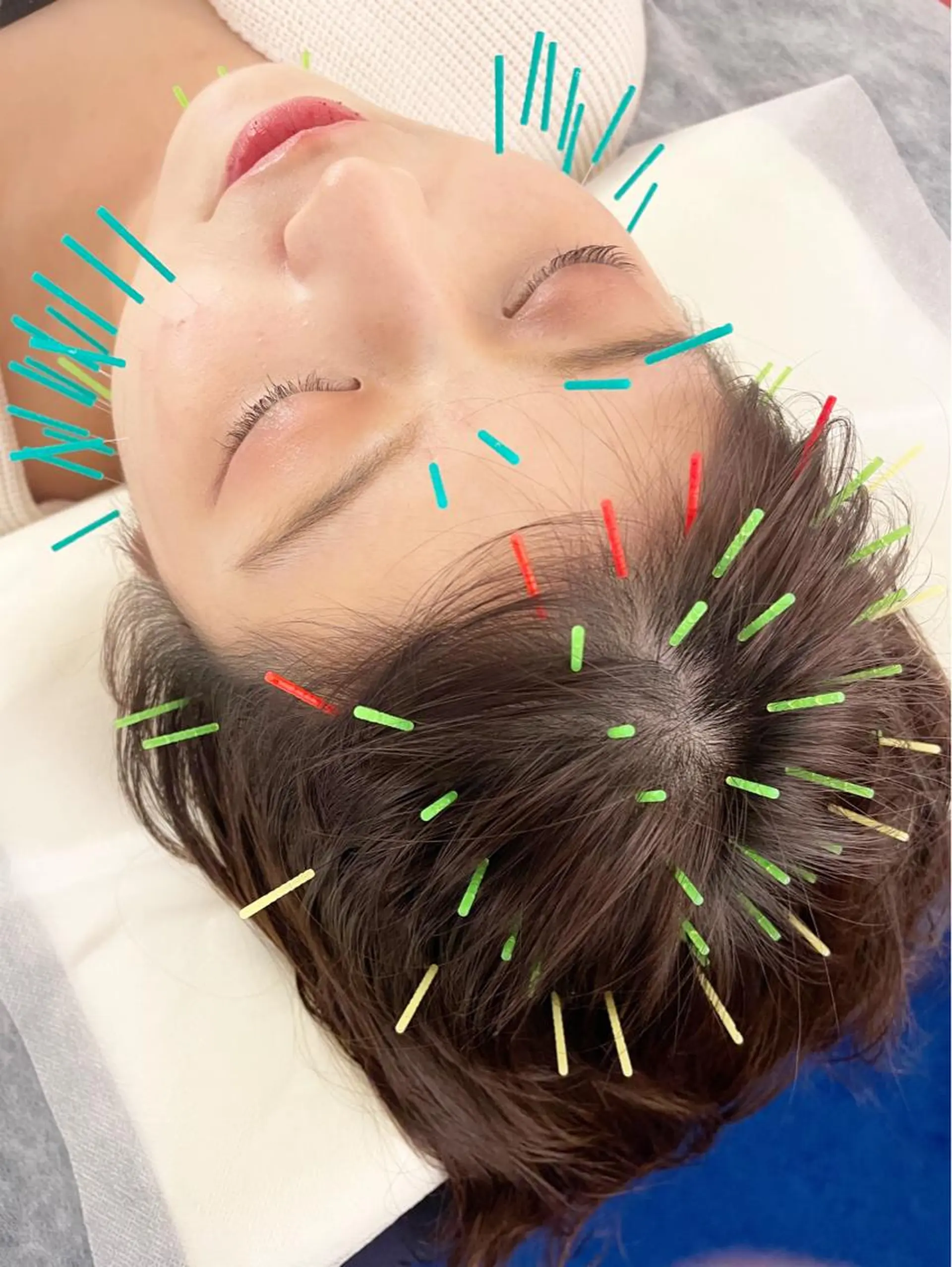 小顔美容鍼専門サロン 渋谷YZのその他イメージ