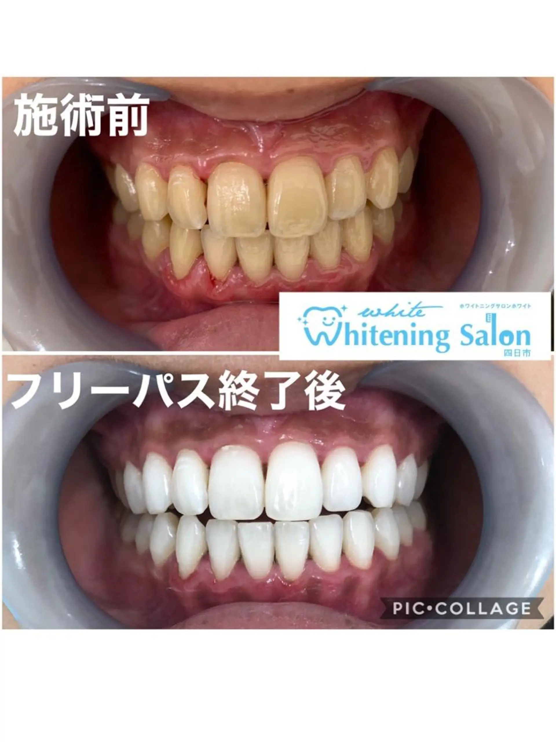 ホワイトニング&アイラッシュ四日市ホワイト所属・アイラッシュ ホワイトニング四日市のマツエク・マツパデザイン