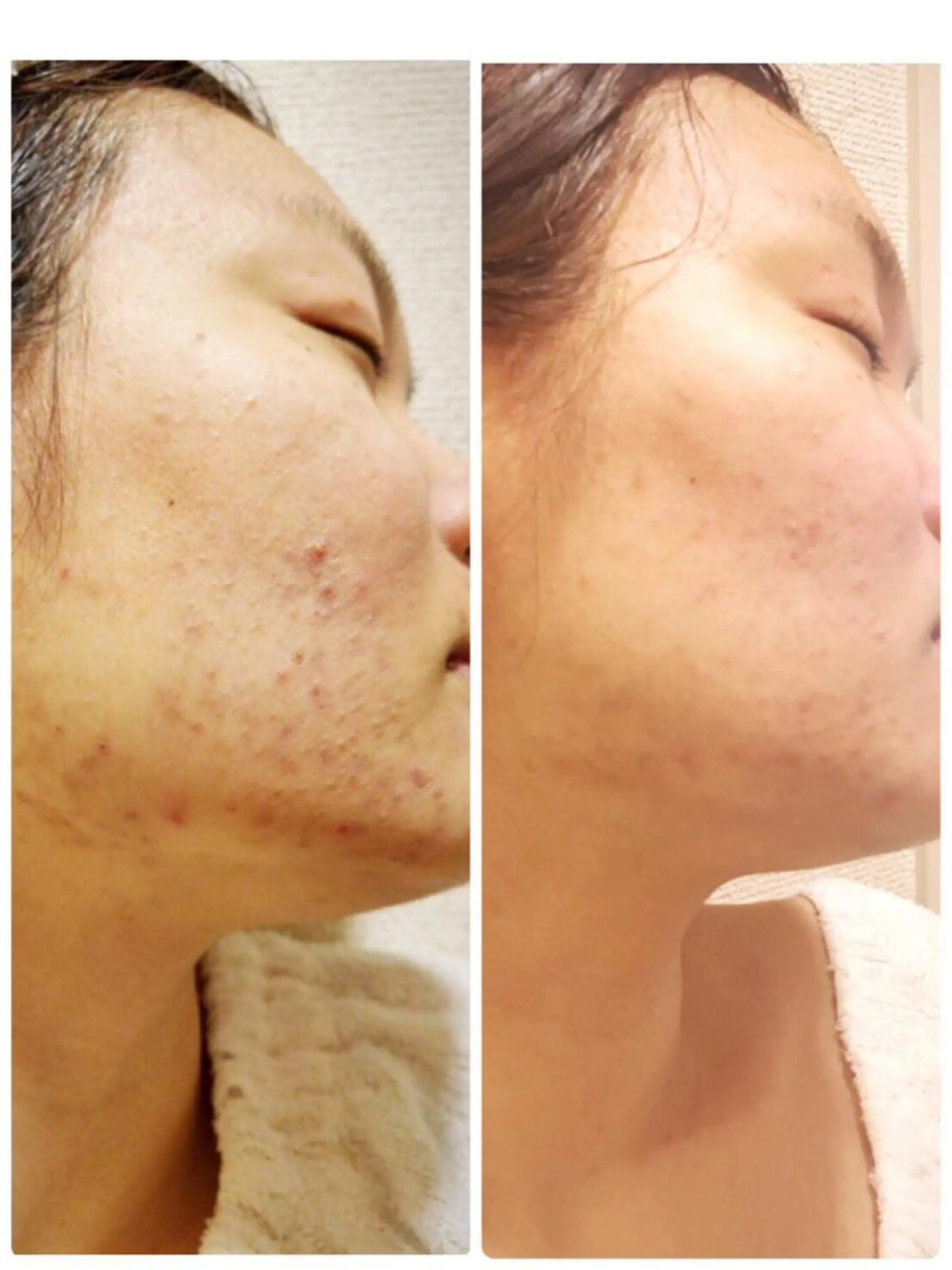 プログレス所属・秋山 香織のエステ・リラクイメージ